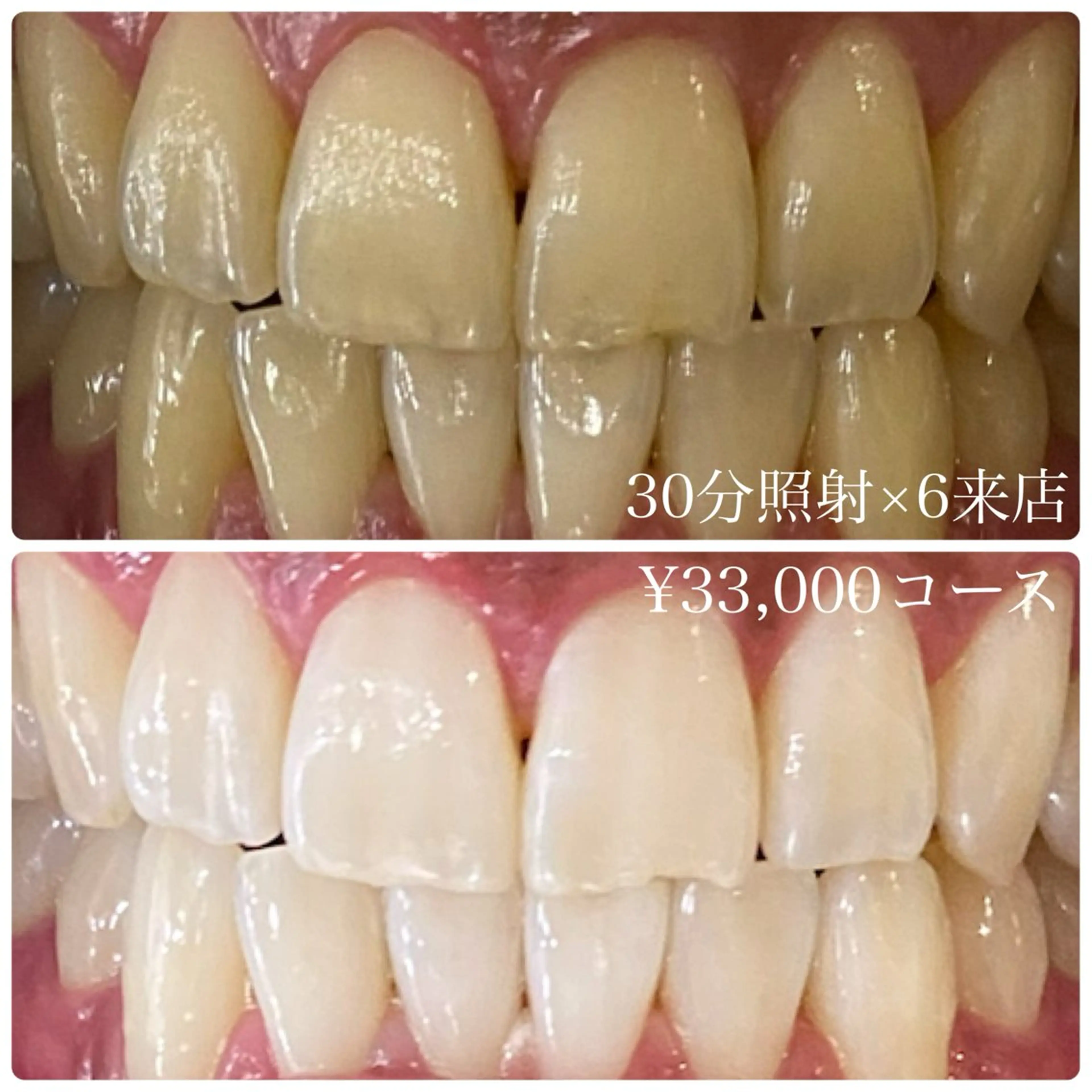 メンズ その他 ホワイトニングルーム　川崎店所属・ホワイトニング ルーム　川崎店のその他イメージ