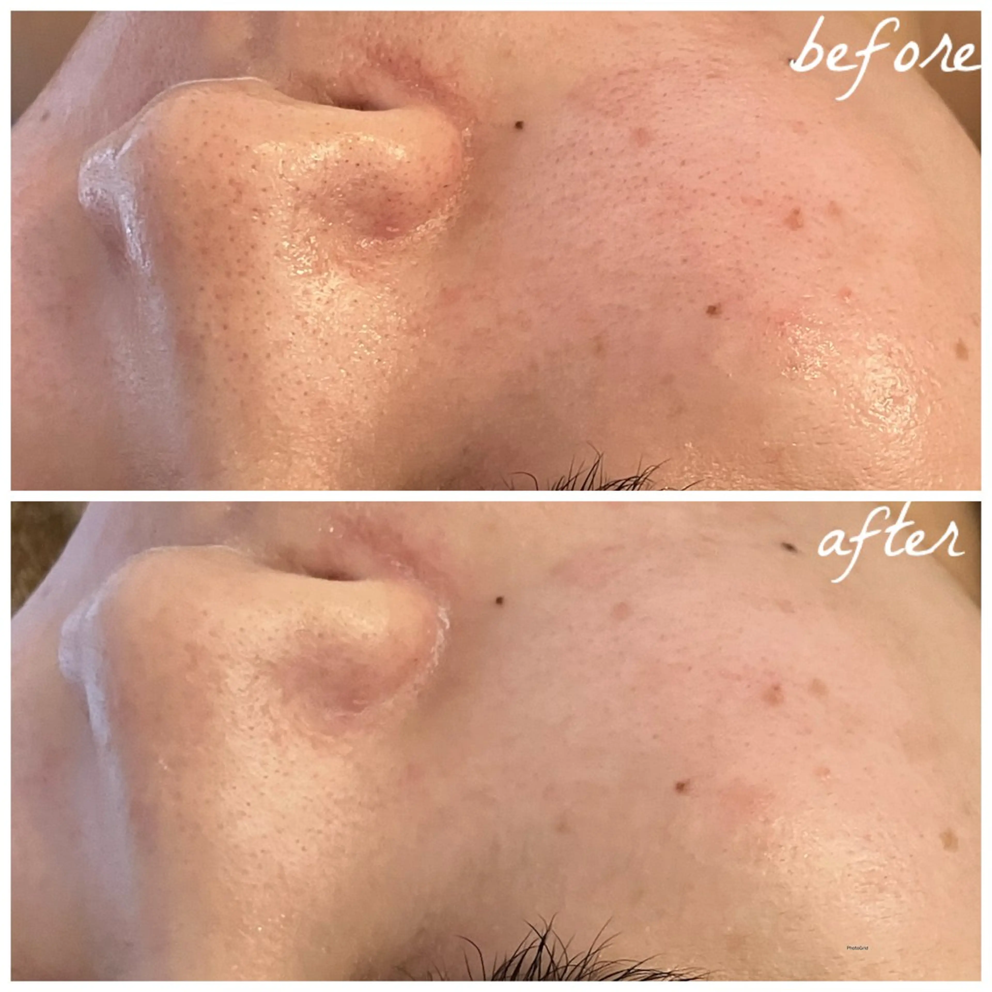 メンズ メナード岐阜茜部 杉浦のエステ・リラクイメージ