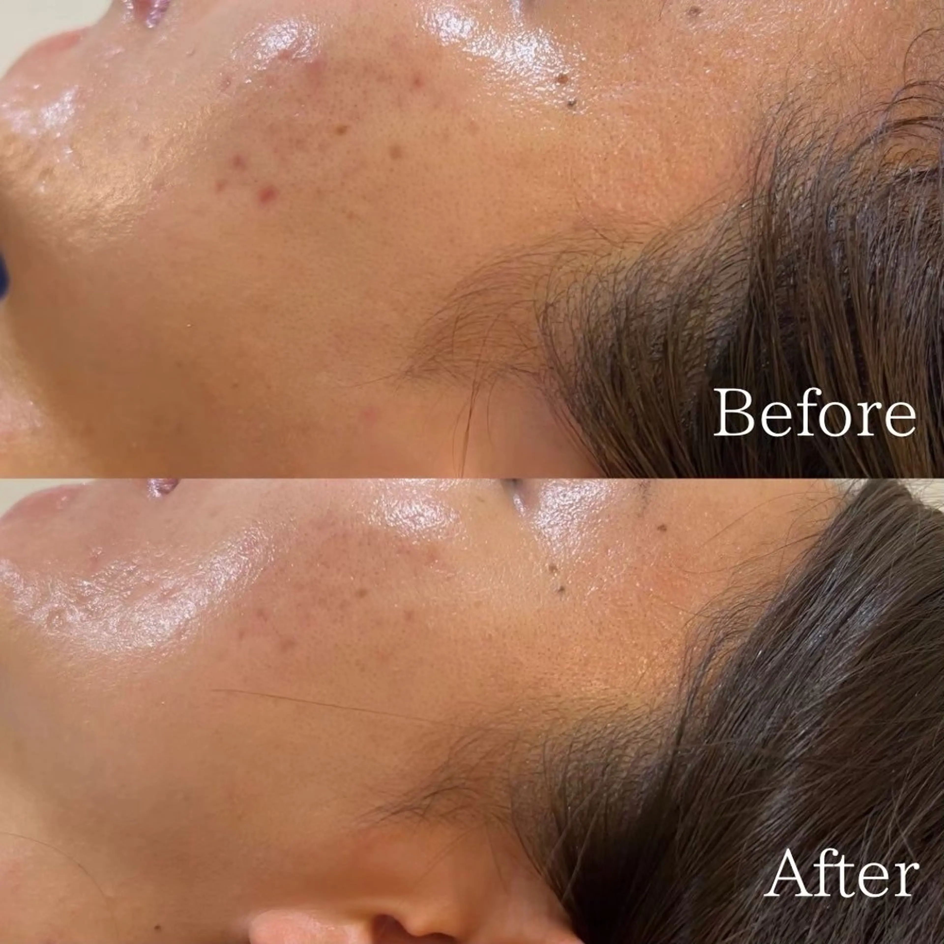 エステ ニキビ改善専門店 d'Albaのエステ・リラクイメージ