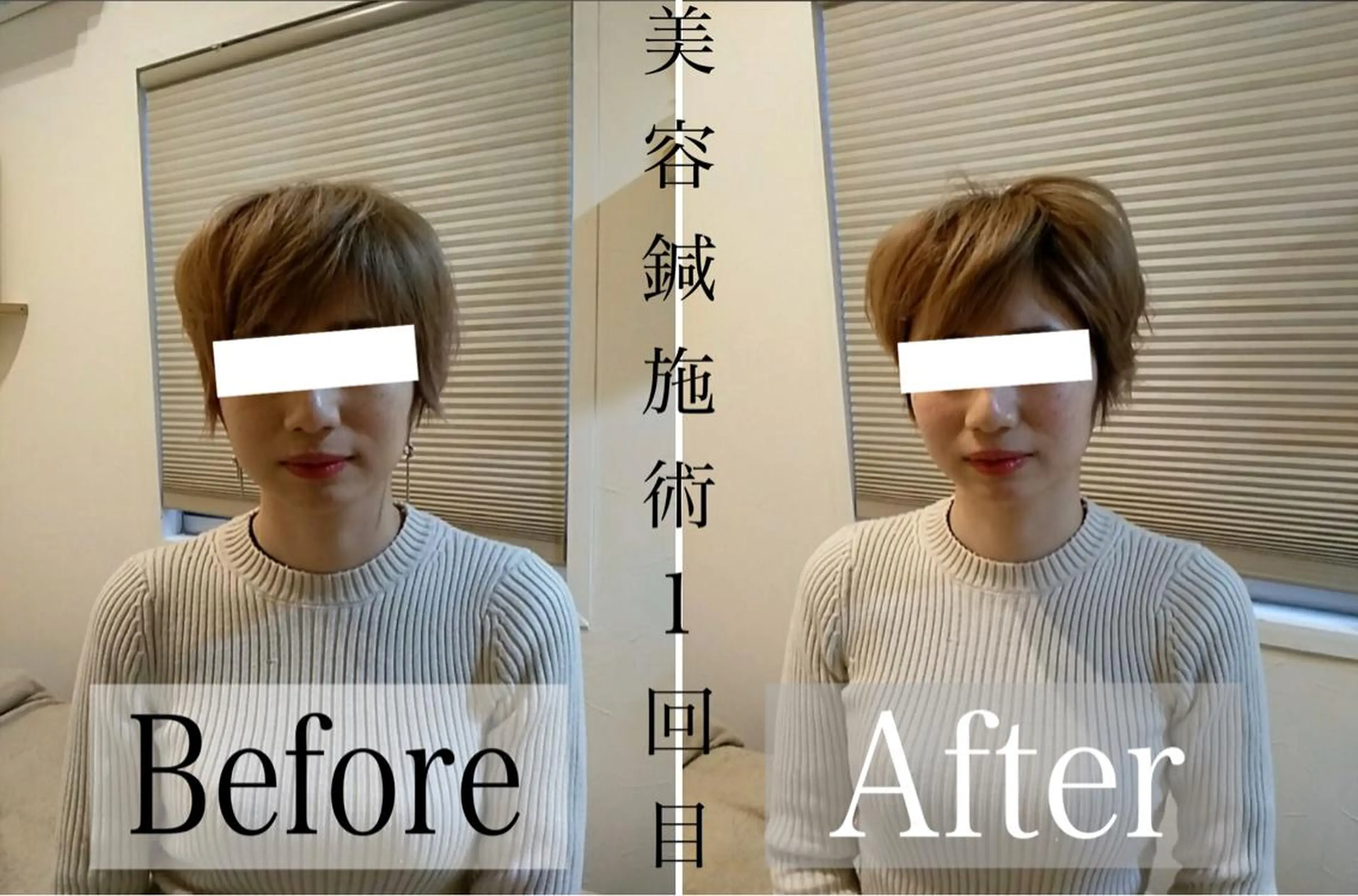 鍼灸整骨院Refine所属・鍼灸 Refineのその他イメージ