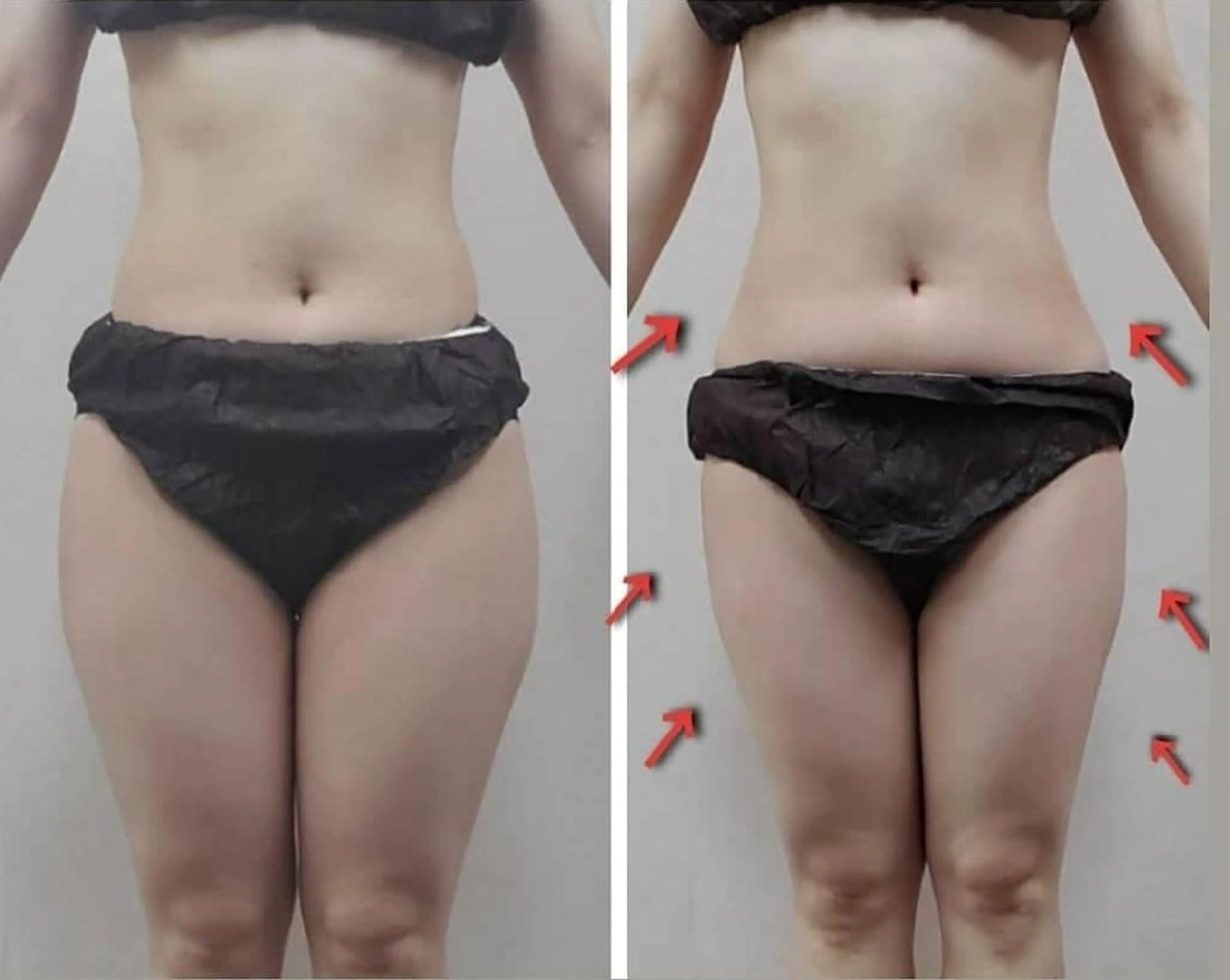 エステ リラク 【 Laforme】 ラ・フォルムのエステ・リラクイメージ