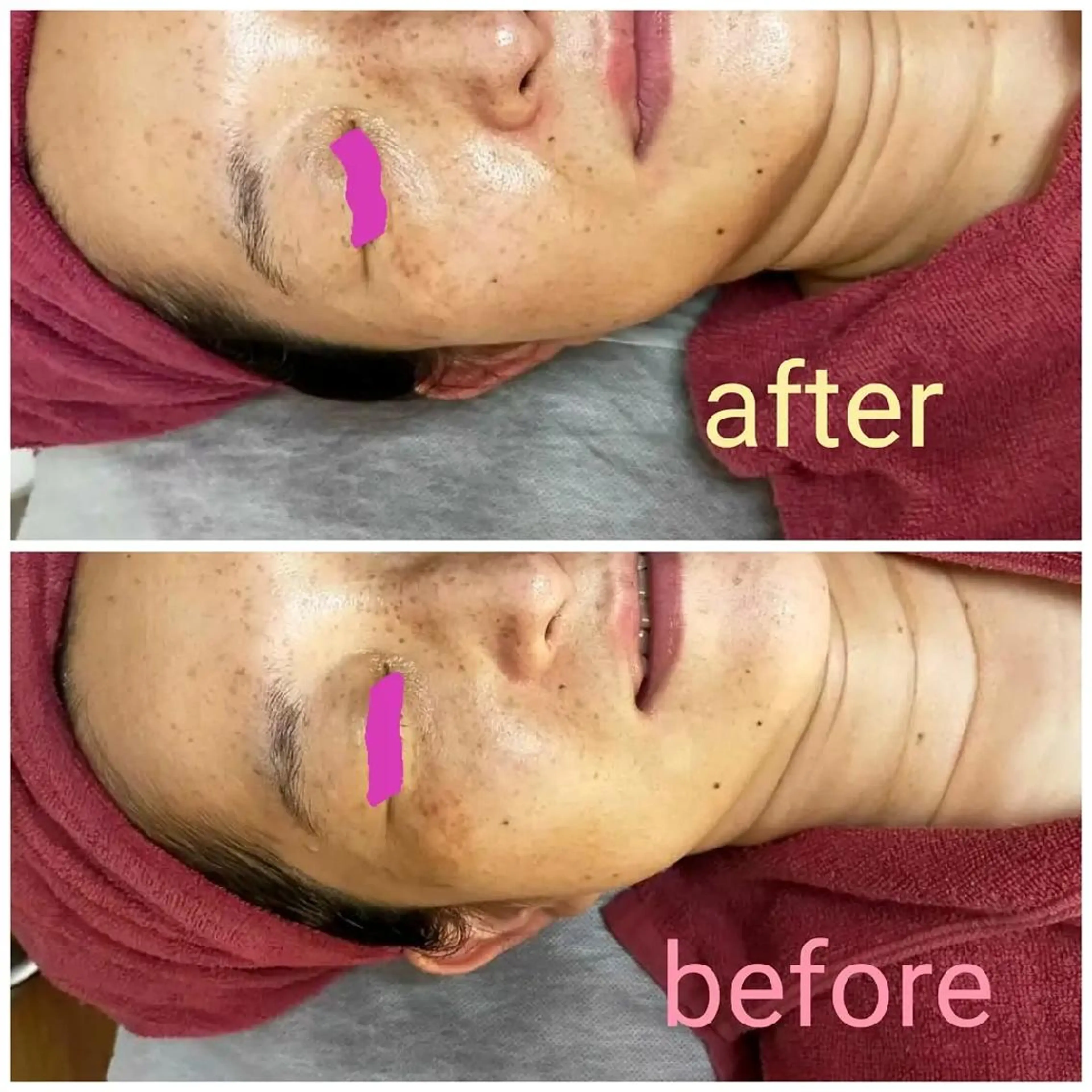 デ・アイム立川所属・美anela ビアネラ石塚仁美のエステ・リラクイメージ