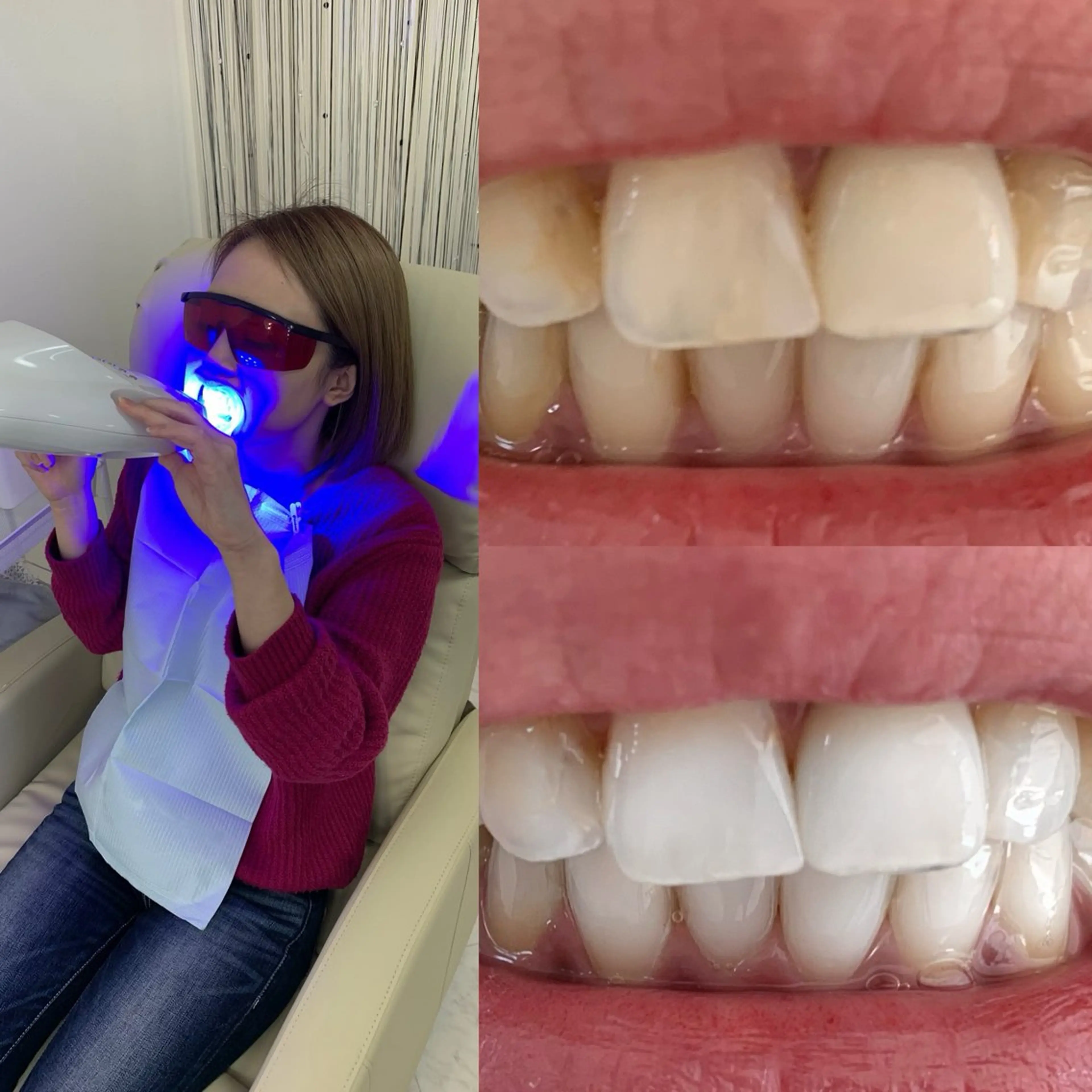 217whitening  room所属・217 ホワイトニングルームのエステ・リラクイメージ