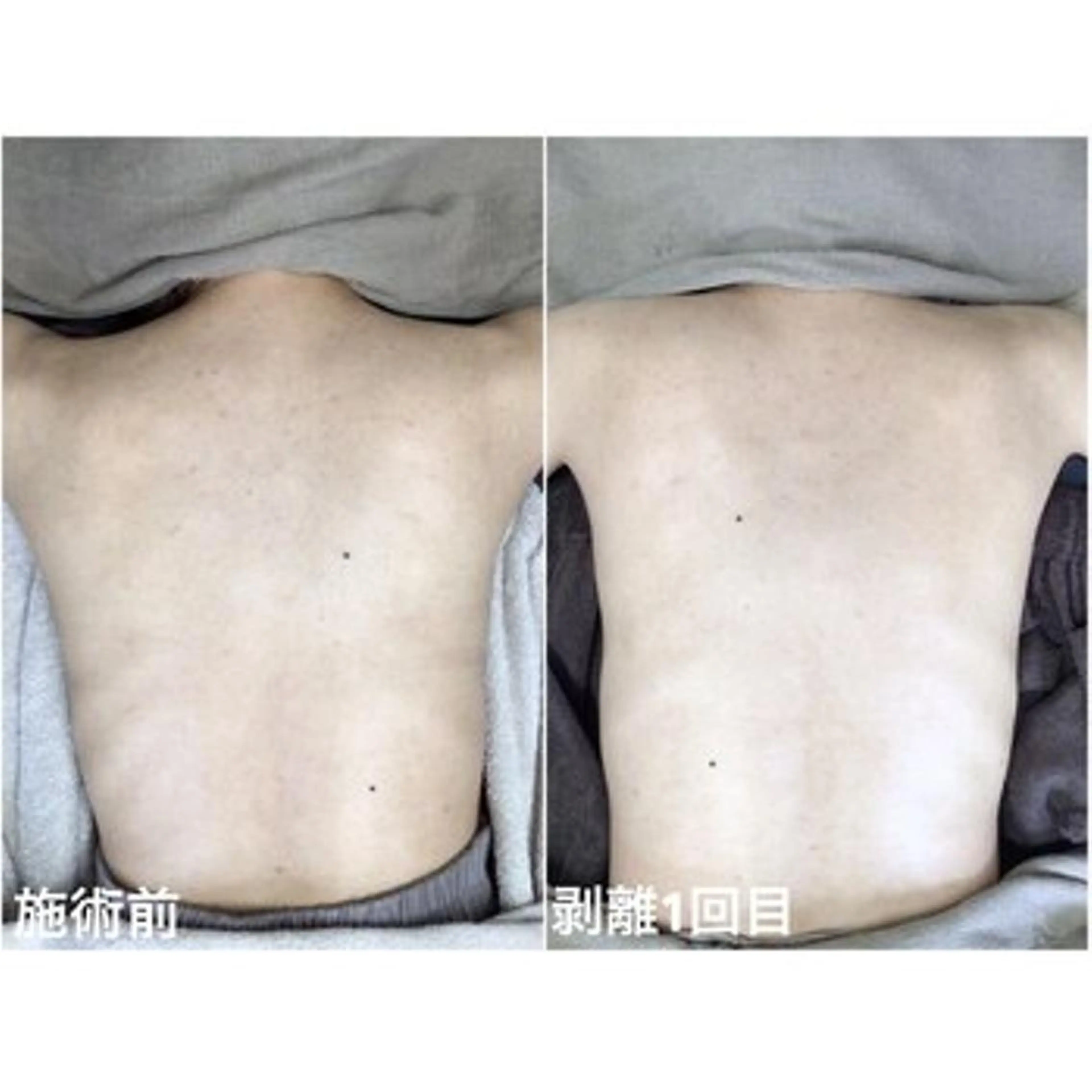 毛穴/毛穴洗浄専門 エミルカ船橋のエステ・リラクイメージ