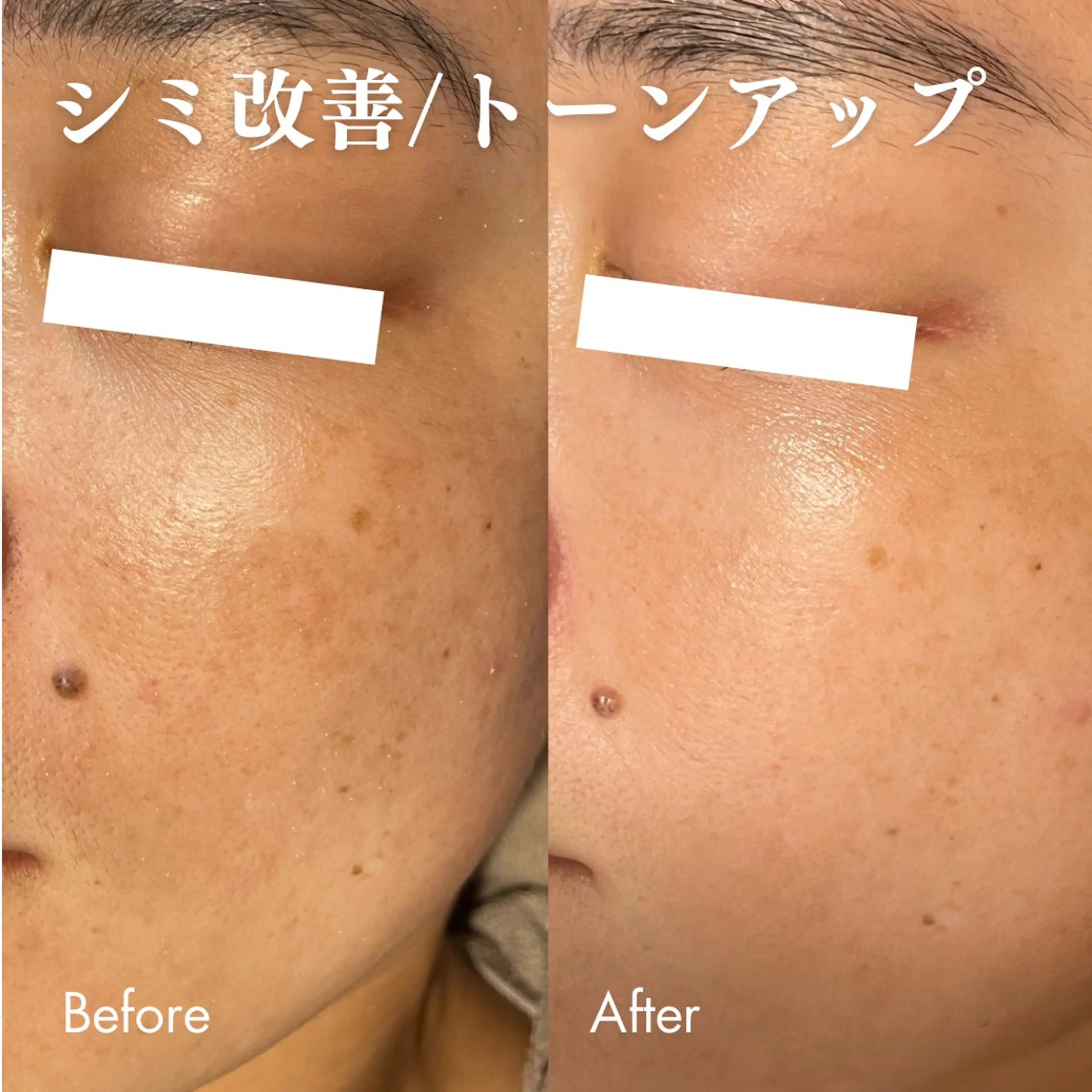 エステ Lassy Yuriの眉毛・アイブロウイメージ