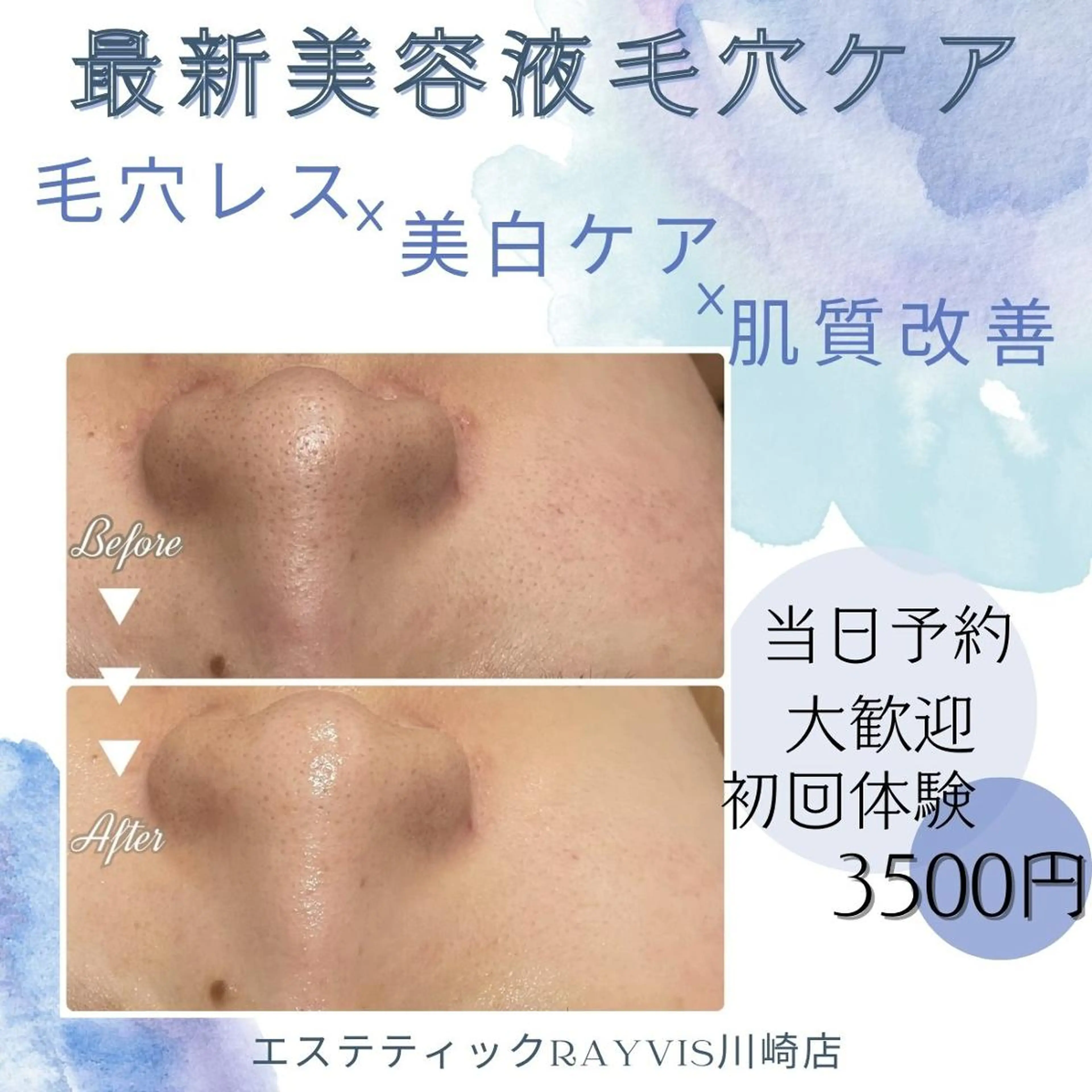 🌿小顔・痩身・脱毛 レイビス川崎店🌿のエステ・リラクイメージ