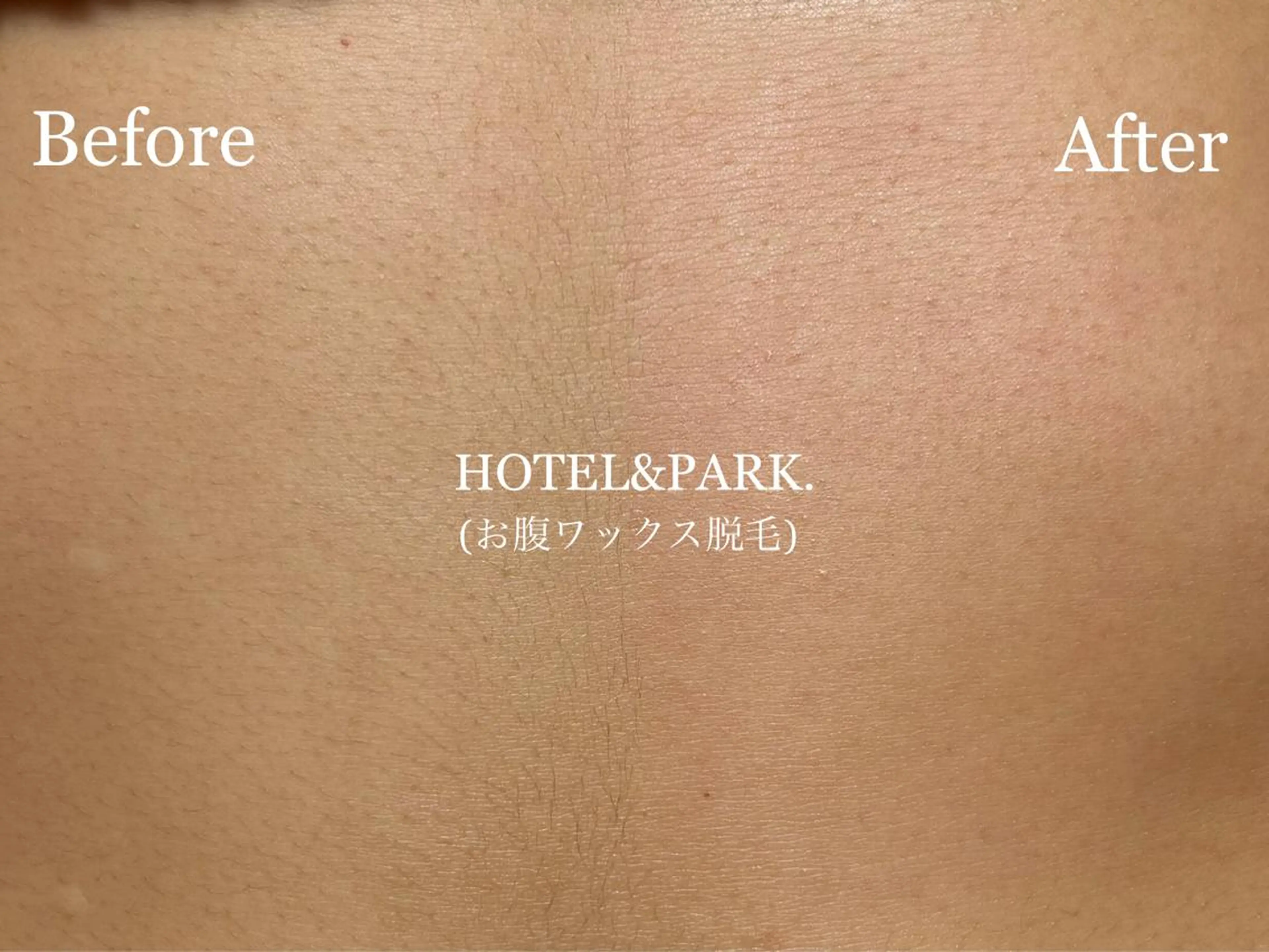 HOTEL&PARK . ワックス脱毛のエステ・リラクイメージ
