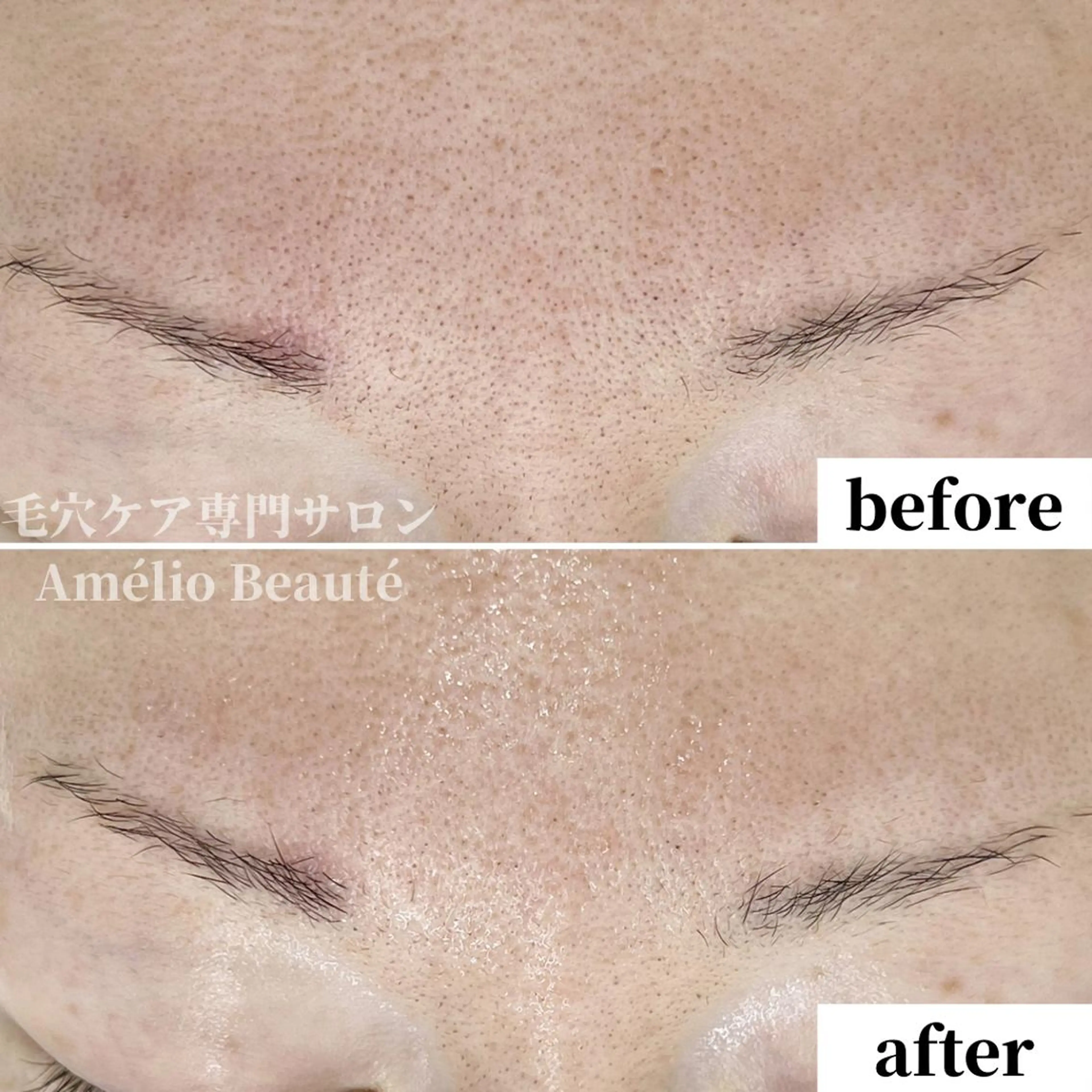 毛穴ケア専門サロン Amélio Beauté所属・毛穴ケア専門サロン アメリオボーテのその他イメージ
