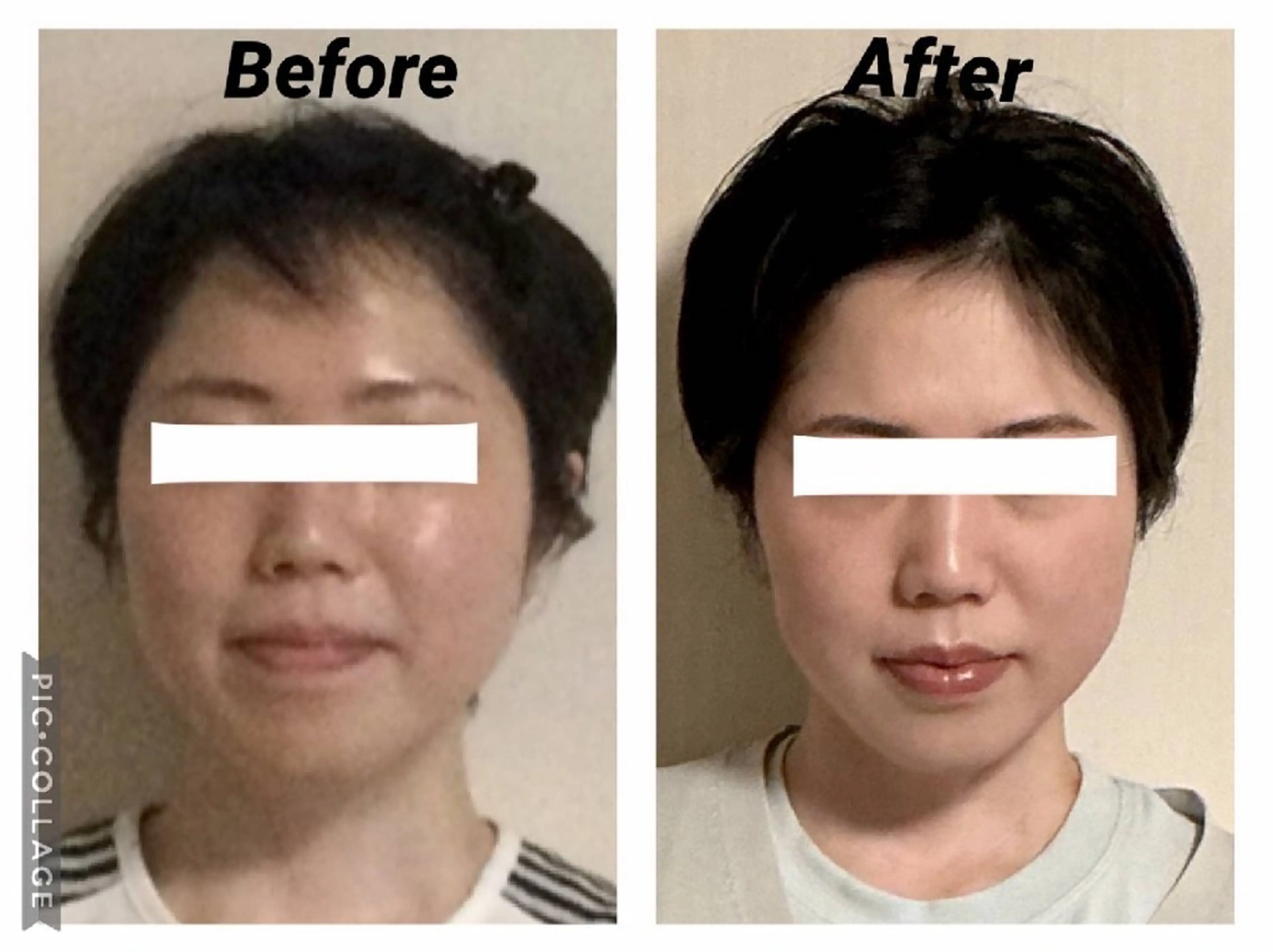 エステ リラク 小顔矯正Sho  FaceDesignのエステ・リラクイメージ