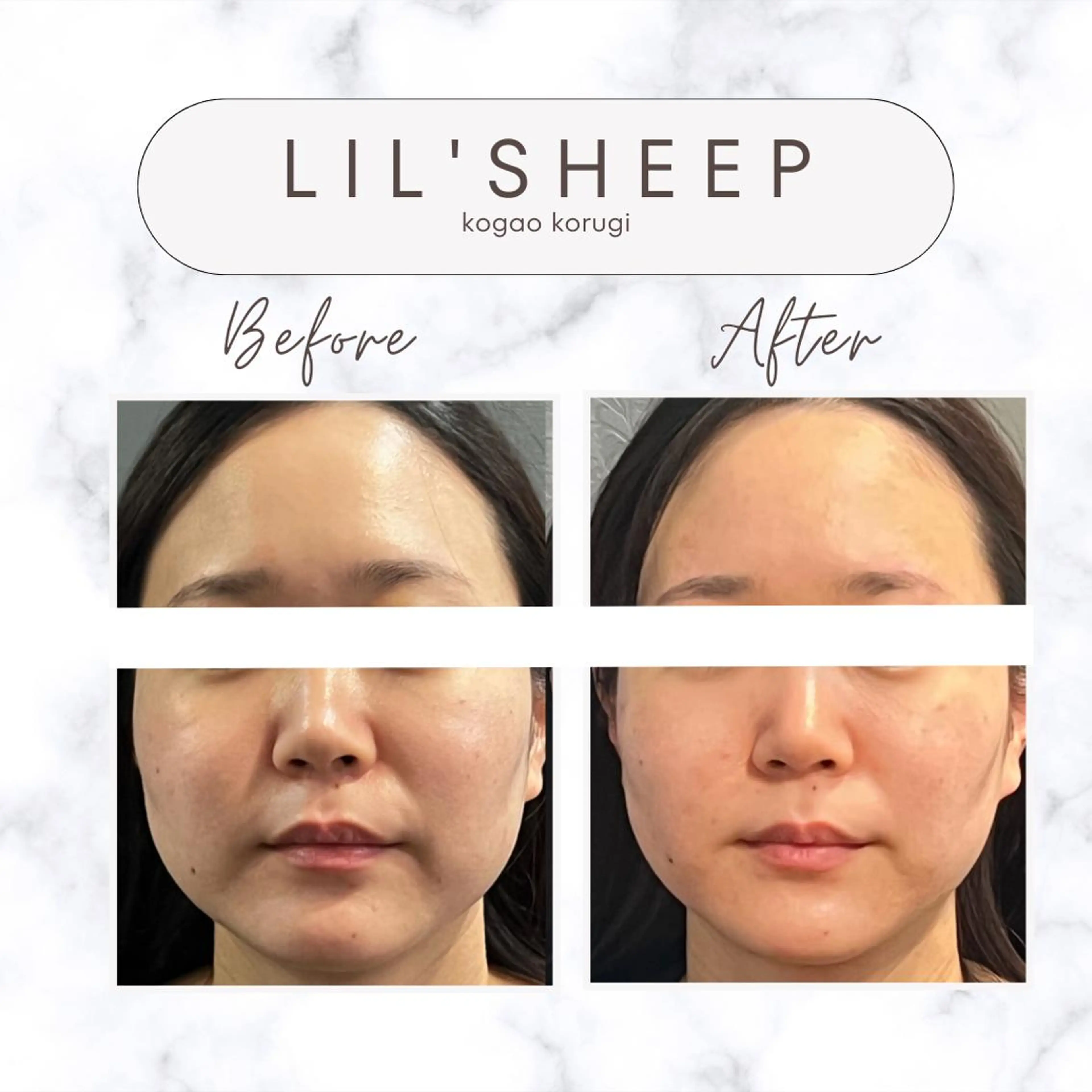 小嶋萌 今池駅徒歩2分のエステ・リラクイメージ