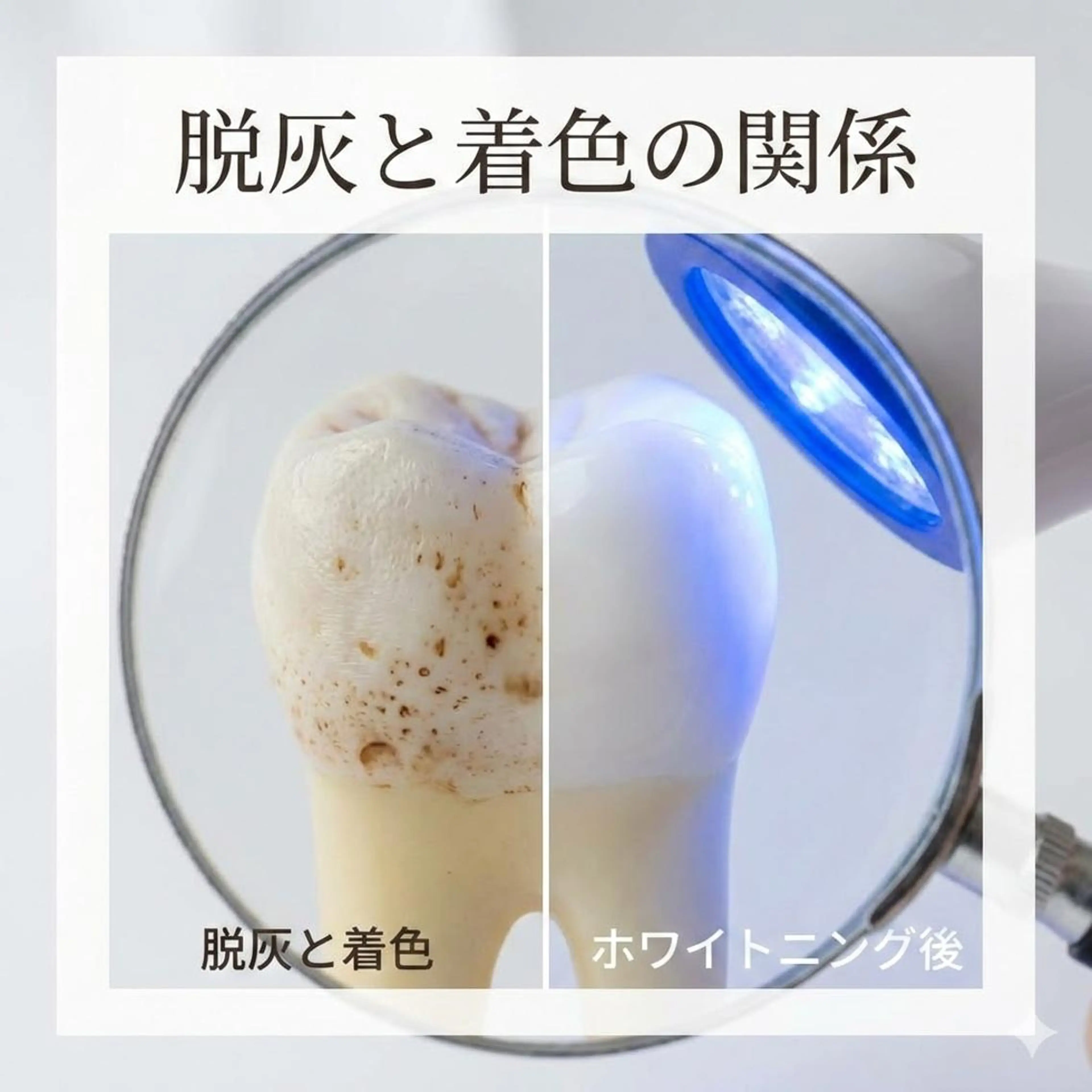 ショート パーマ ホワイトニングサロン nico西葛西店のその他イメージ