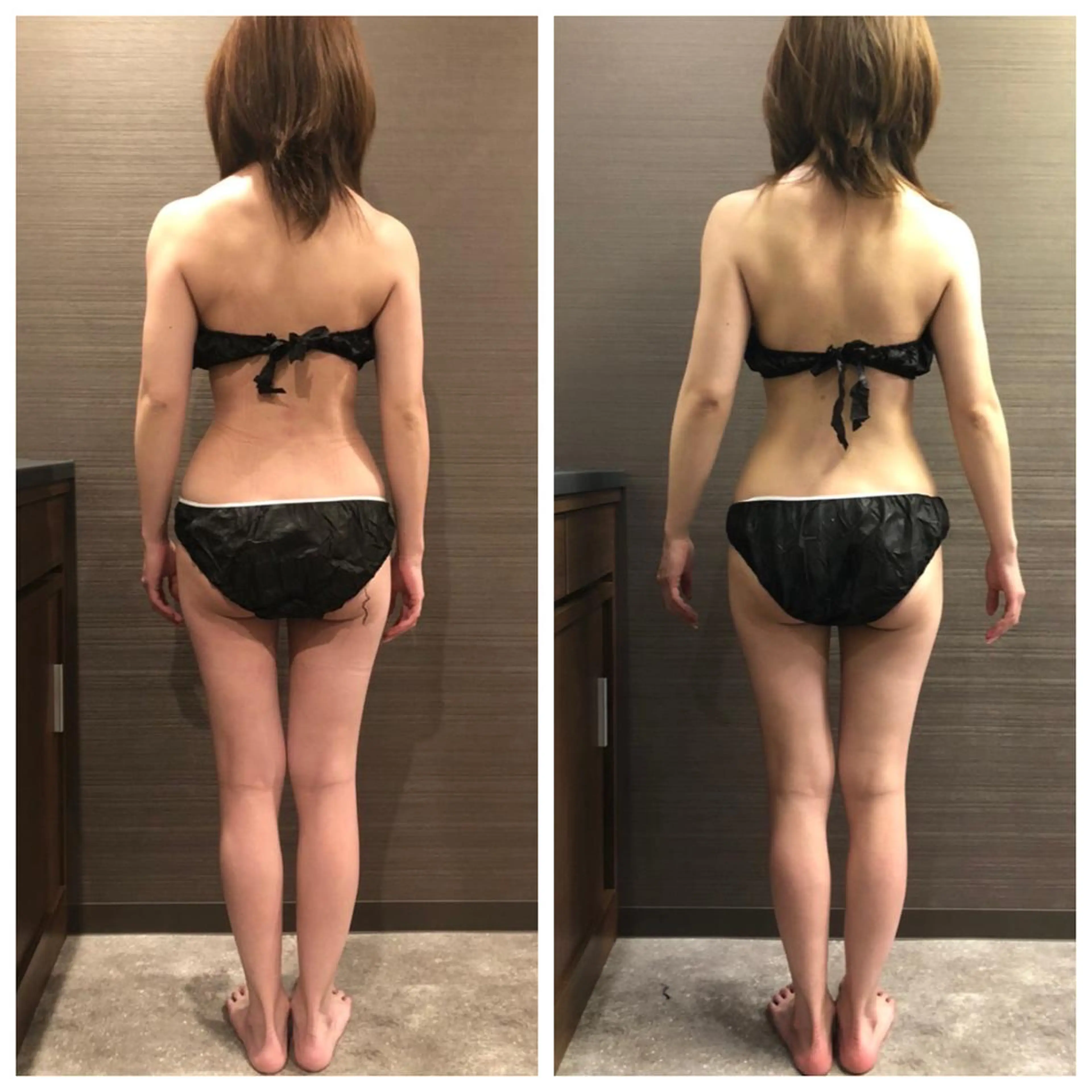 新メニュー導入キャンペーン⭐︎軟部組織リリース【痛くない筋膜リリース】の写真