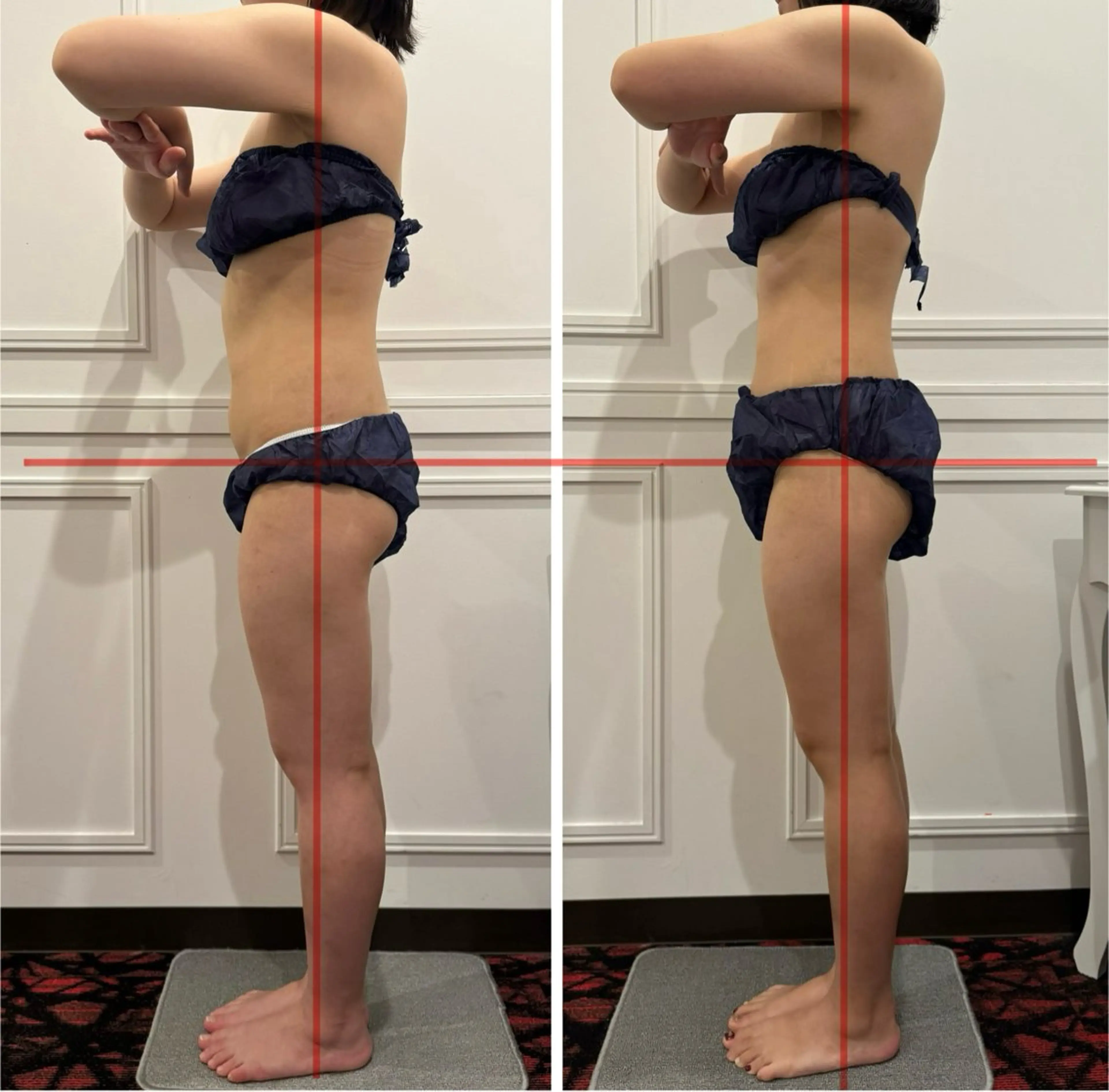 ⋆͛📢私のおすすめ🥇痩身満足度NO.1‼️姿勢×痩身▶今まで無かった骨格から変える痩身❤️‍🔥全身姿勢矯正付き！の写真