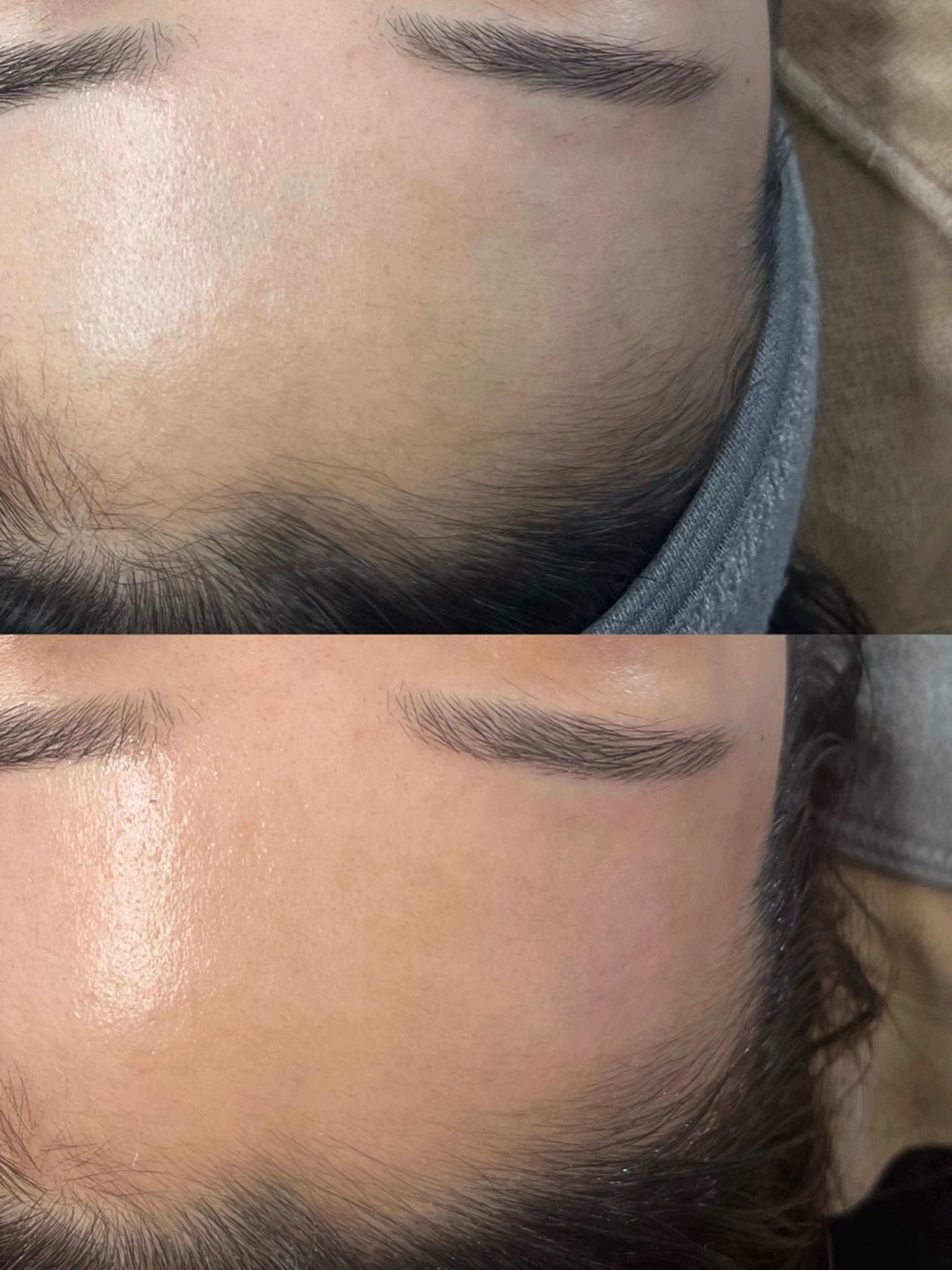 フェイスワックス+眉毛ワックス⚠️ご予約枠はお電話でご確認くださいの写真