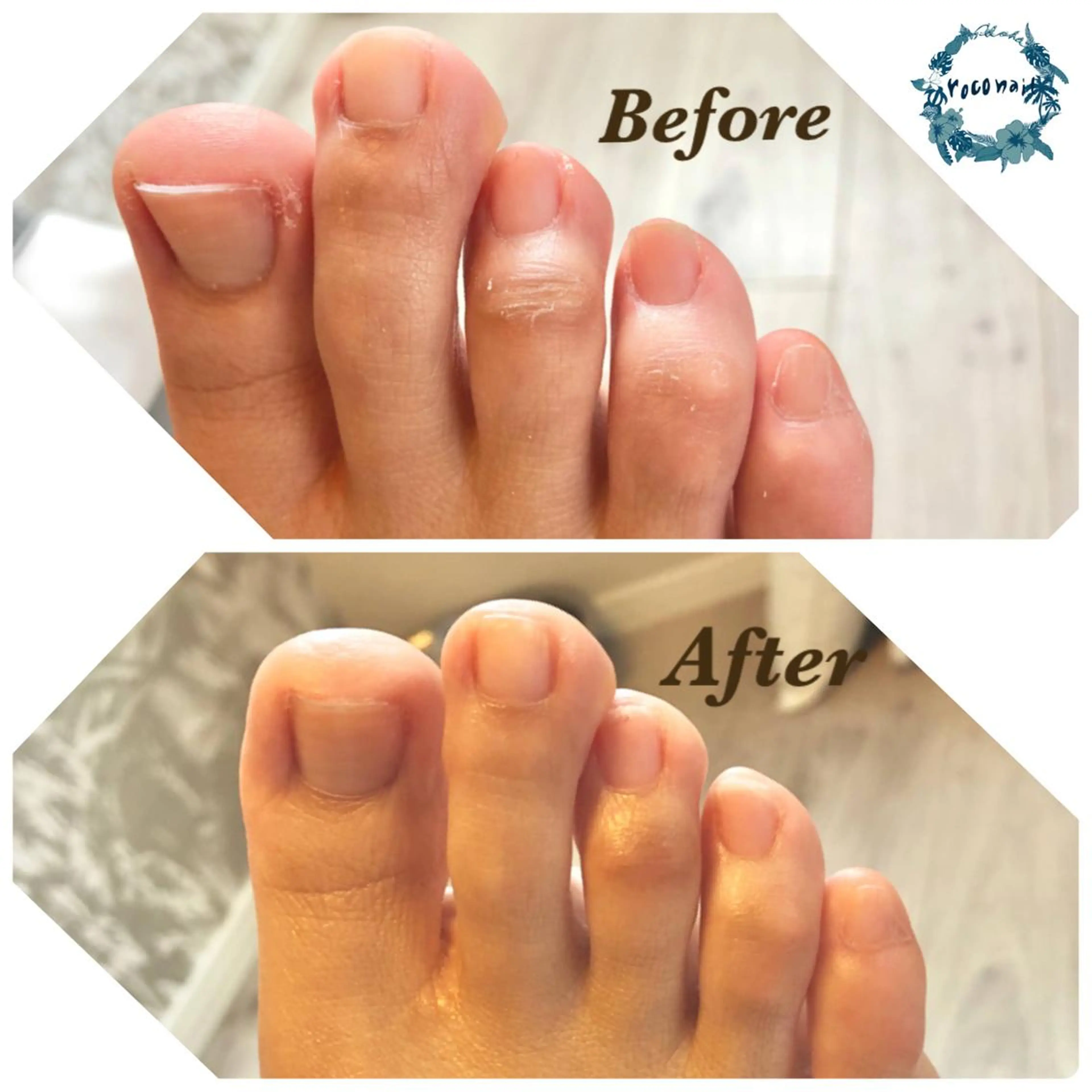 ネイル フットネイル オフィスネイル roconail ヒロコのネイルデザイン