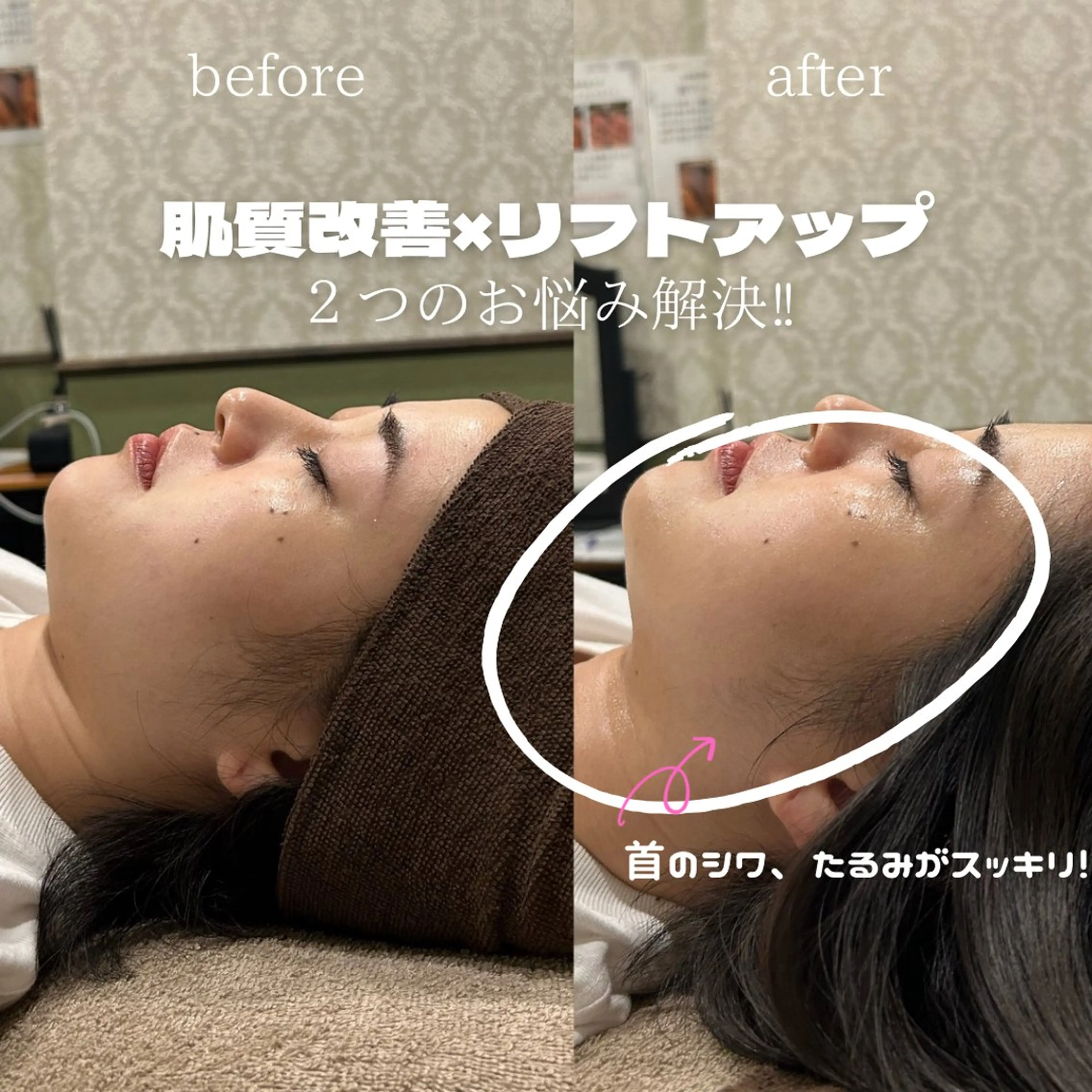 エステ 💎美容革命ラボ💎 大名店のエステ・リラクイメージ