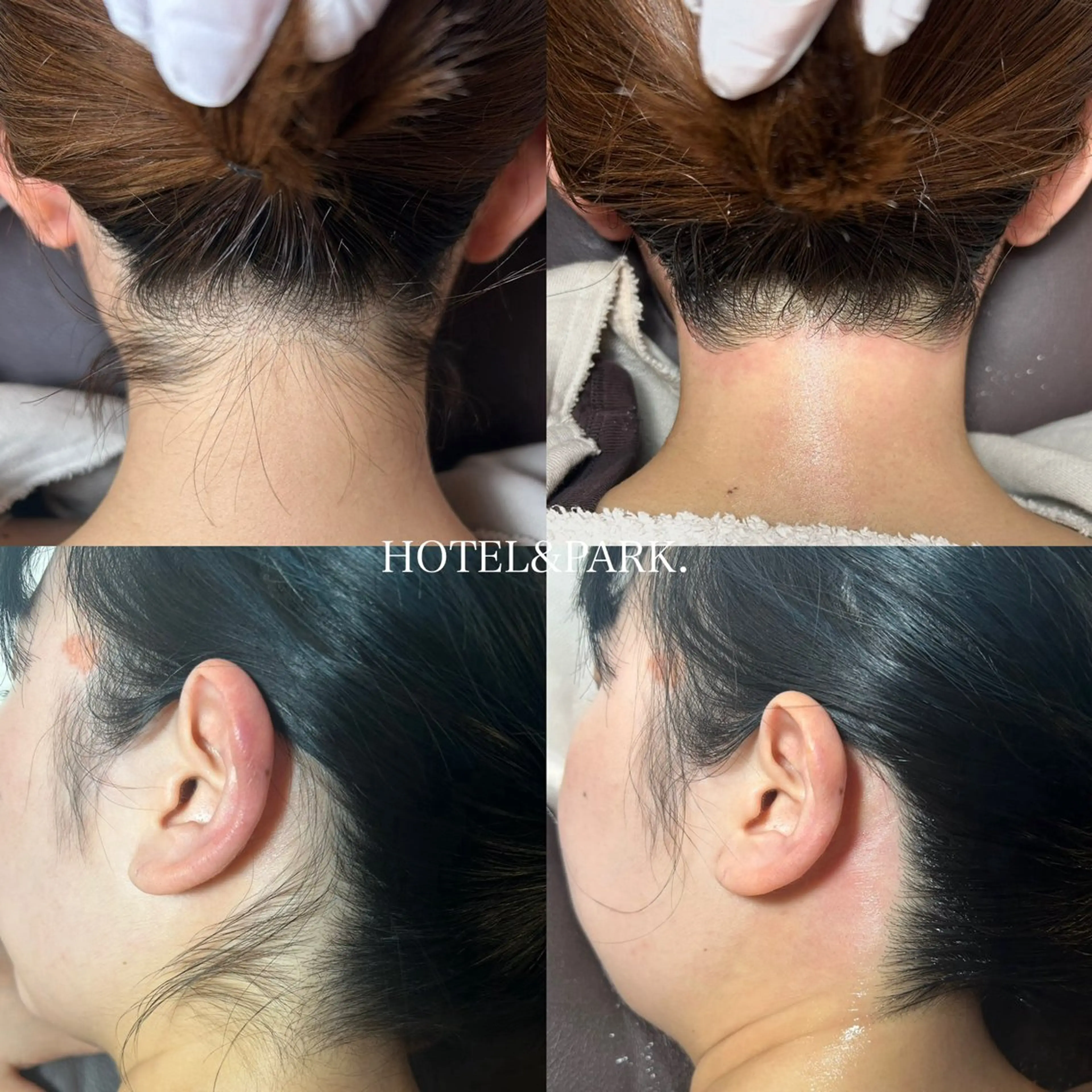 HOTEL&PARK .Moeワックス脱毛のエステ・リラクイメージ