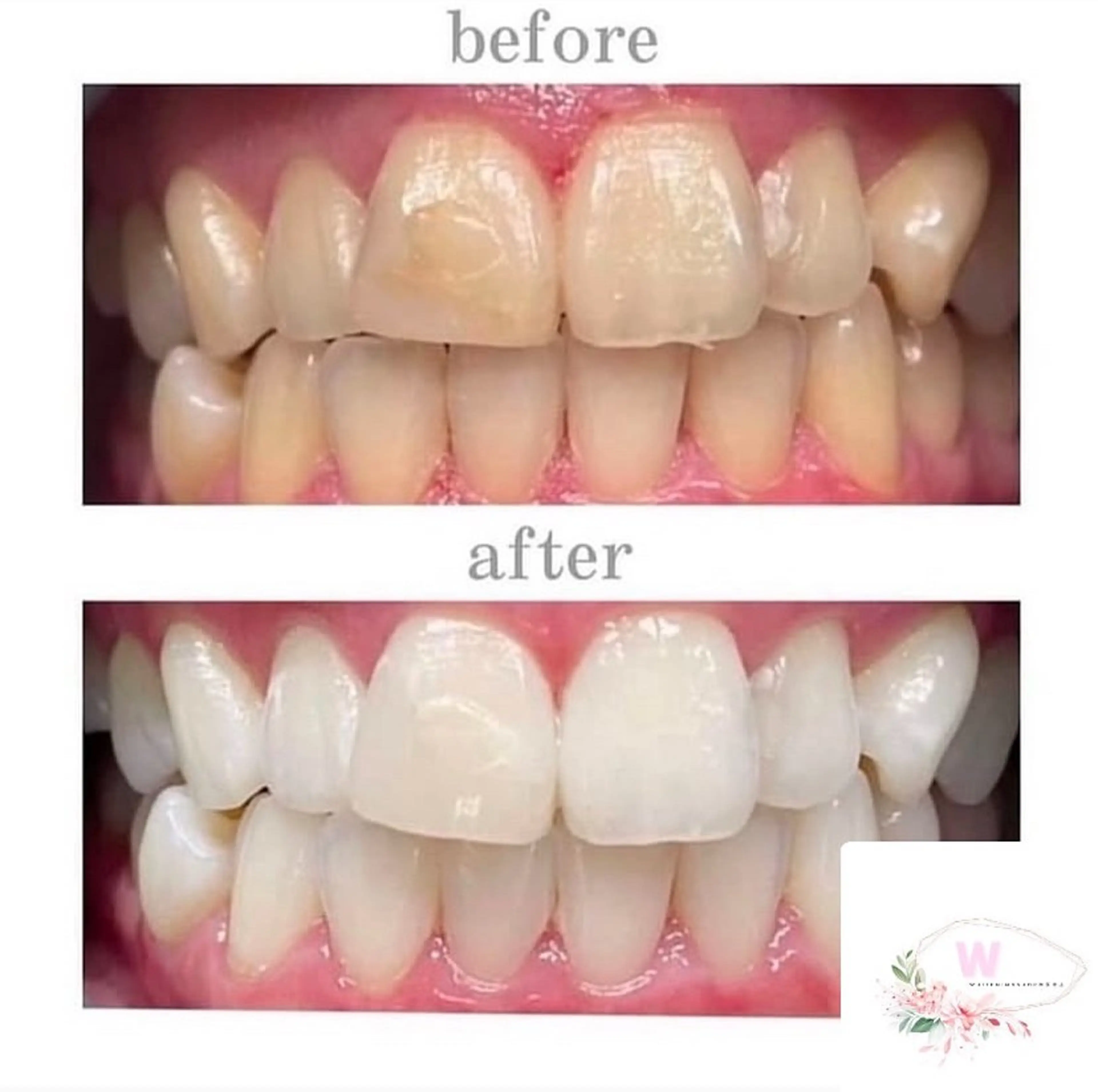 ホワイトニング ショップ本厚木のその他イメージ