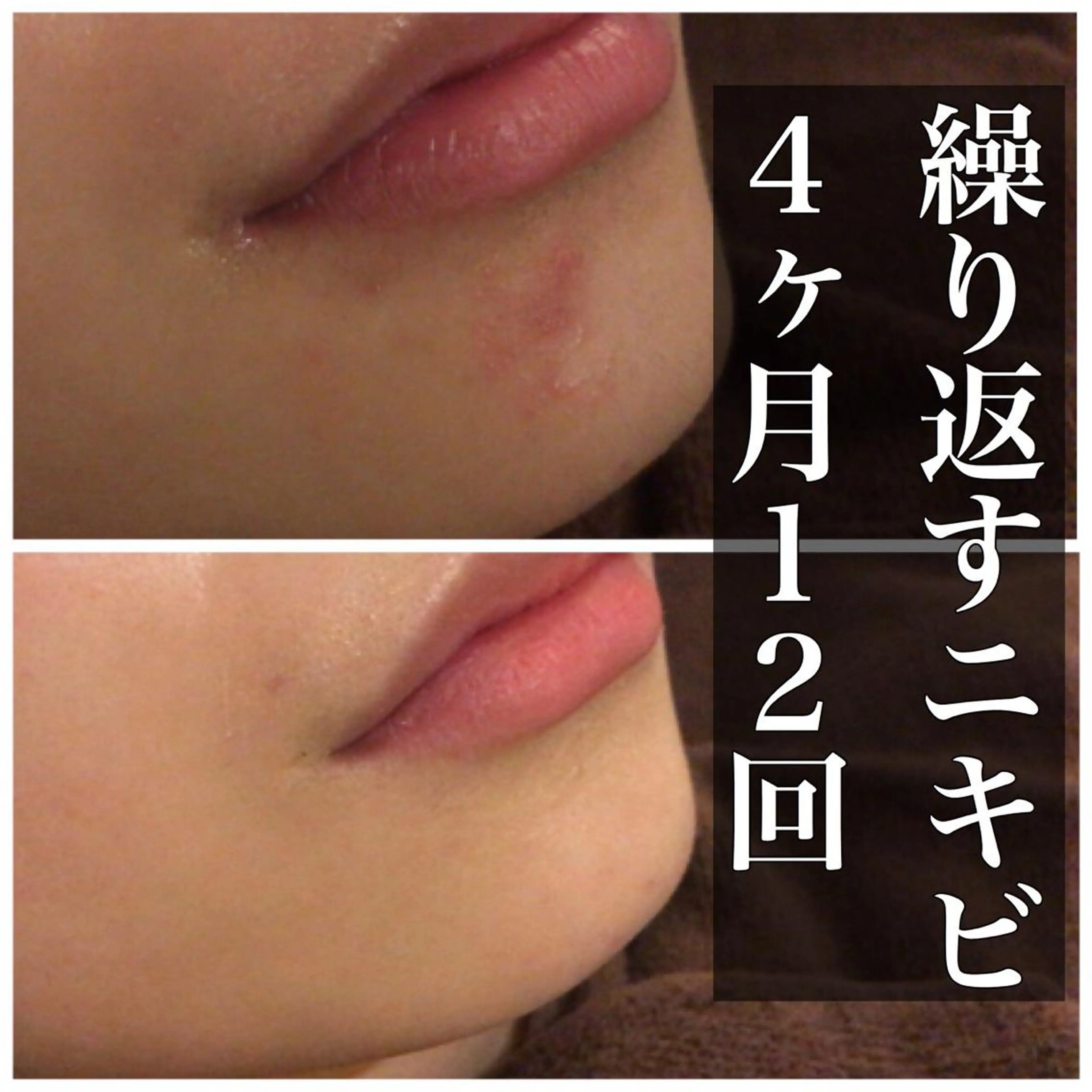 ミディアム カラー パーマ ヘアアレンジ メンズ キッズ ネイル マツエク・マツパ エステ リラク ニキビ・肌質改善専門 ♡人生が変わるサロンのエステ・リラクイメージ