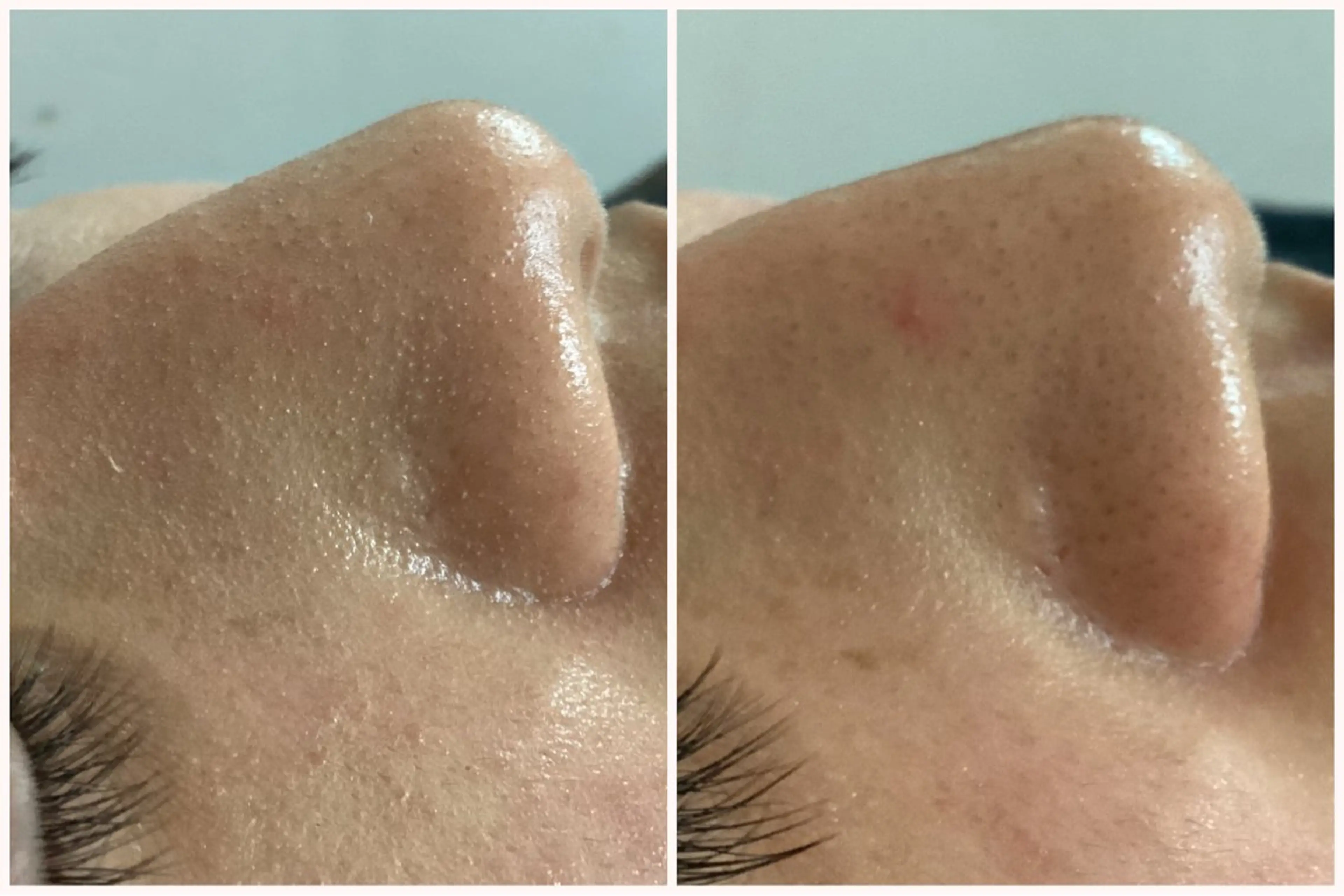 ize 横浜店のエステ・リラクイメージ