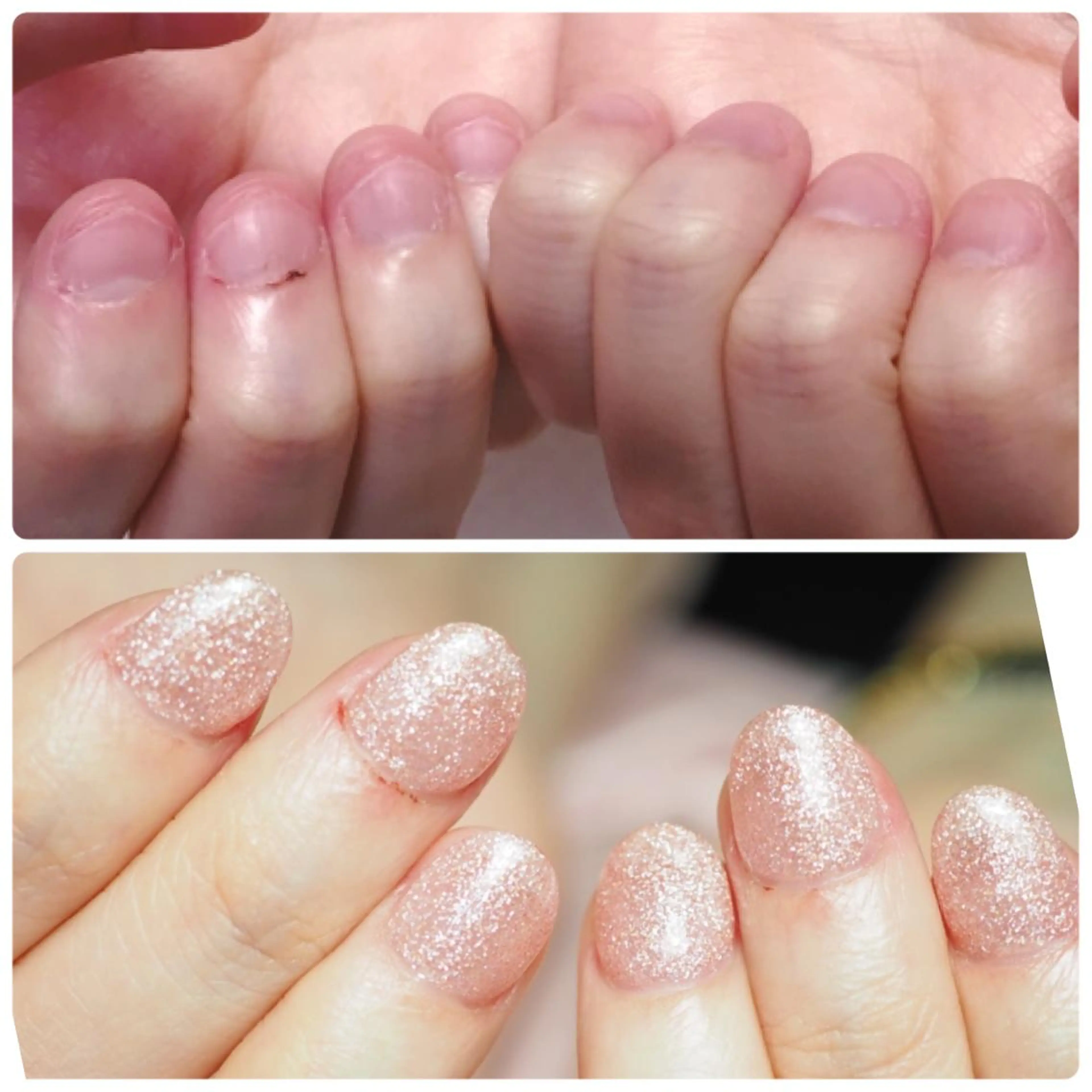 ネイル ハンドネイル 深爪を断らない スカルプ高評価店のネイルデザイン