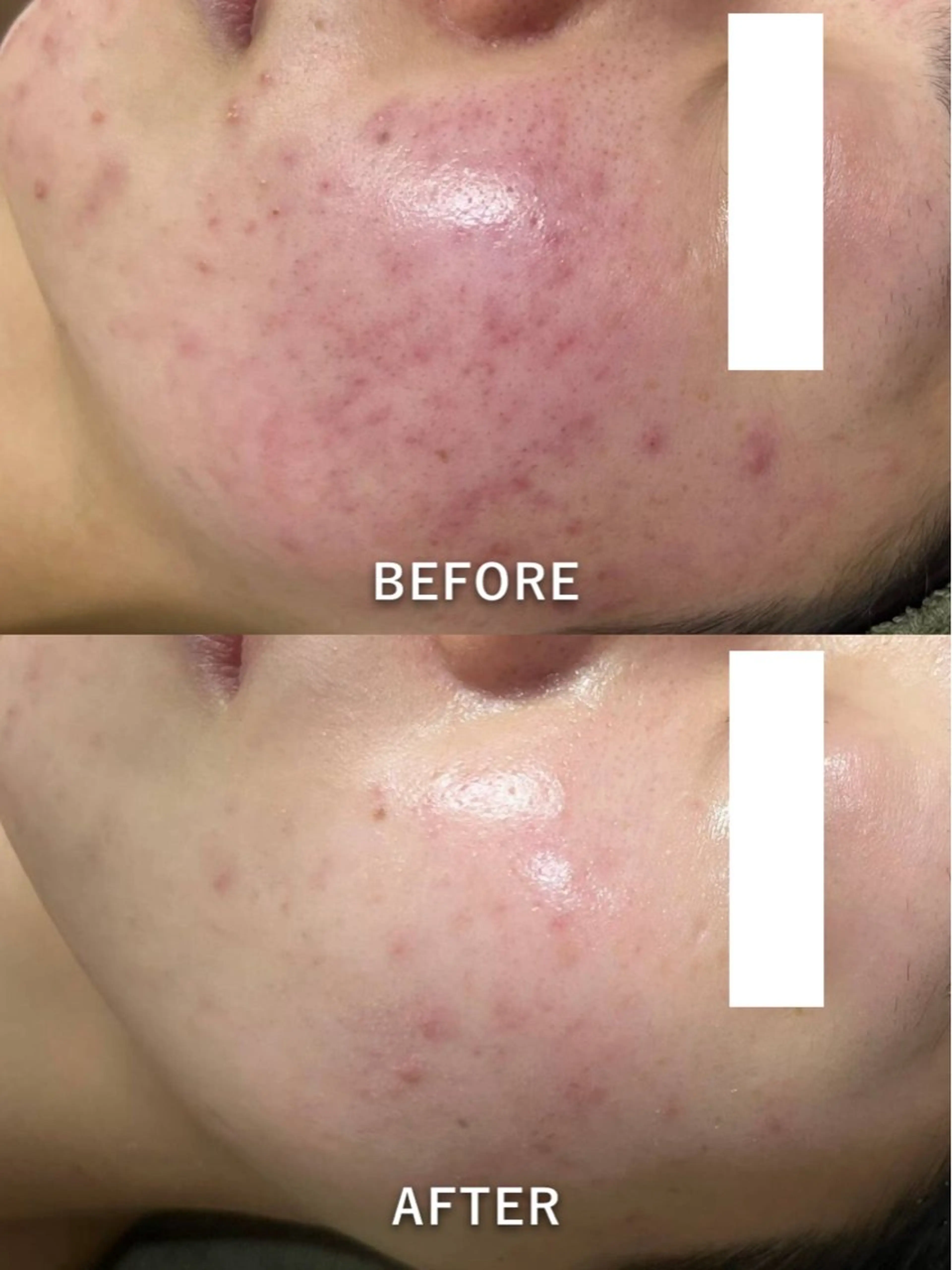 韓国美肌/肌質改善 【天神】yuiのエステ・リラクイメージ