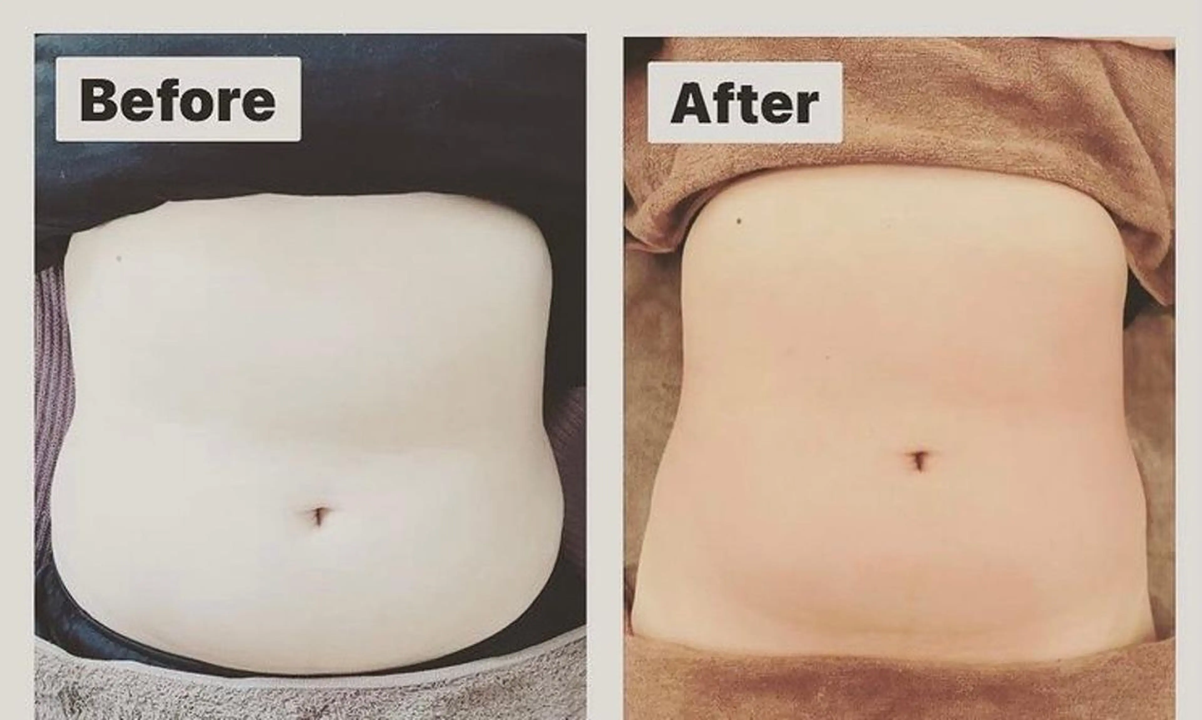 その他 美顔秘密基地新宮所属・美顔秘密基地 新宮のその他イメージ