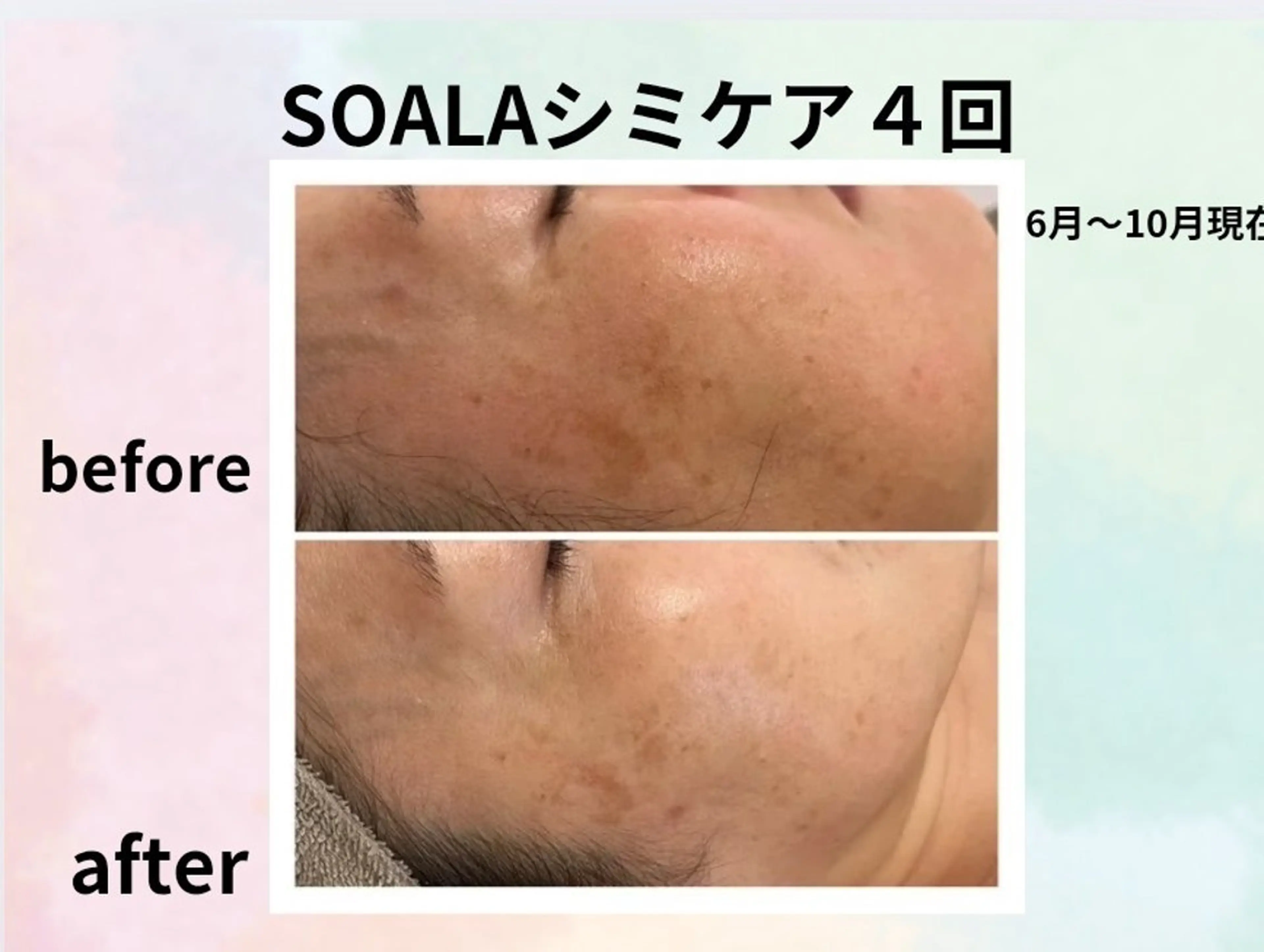 エステ 整体師  江上のその他イメージ