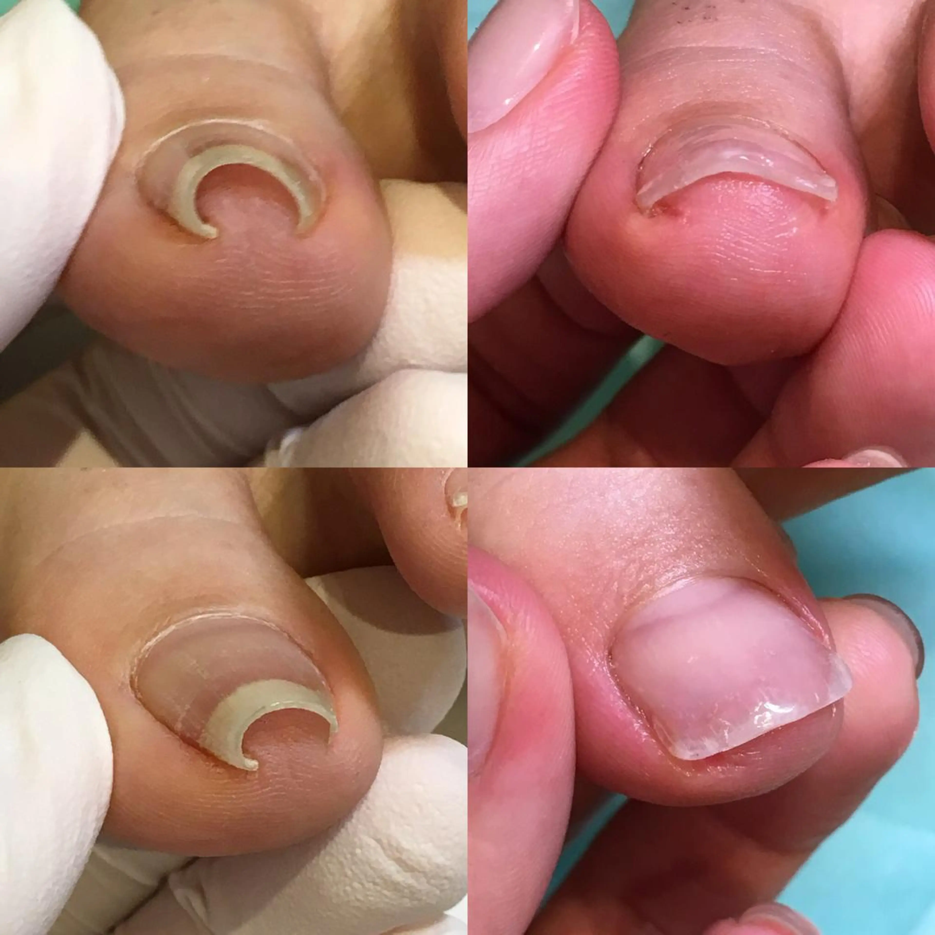 ネイル 東京巻き爪アカデミー所属・東京巻き爪 アカデミーのエステ・リラクイメージ