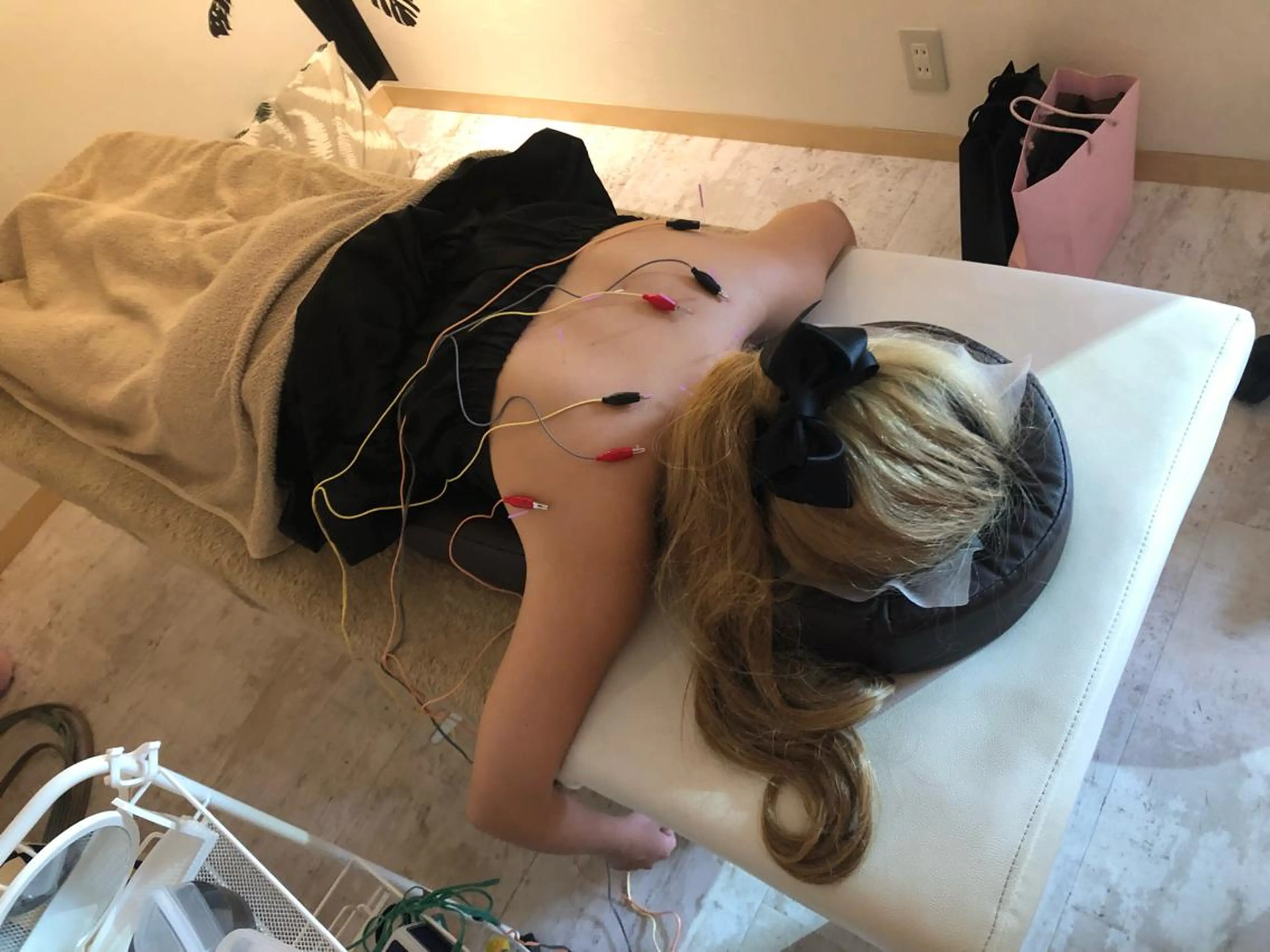 パルス鍼施術筋肉の凝りに鍼を刺してそこに電気を流して凝りをほぐしていきます。の写真