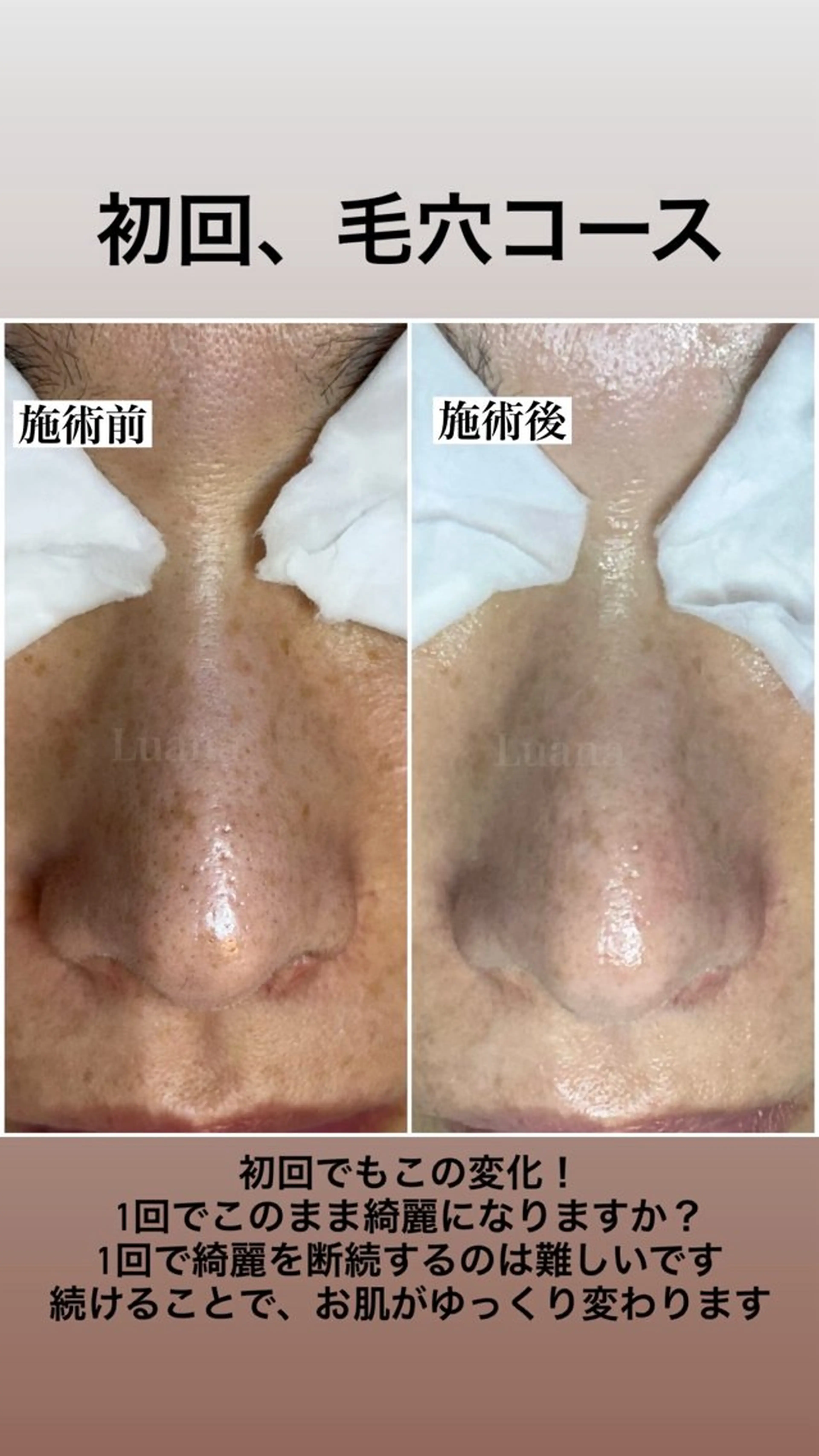 マツヤニWax専門/ 岸和田/Luanaのエステ・リラクイメージ