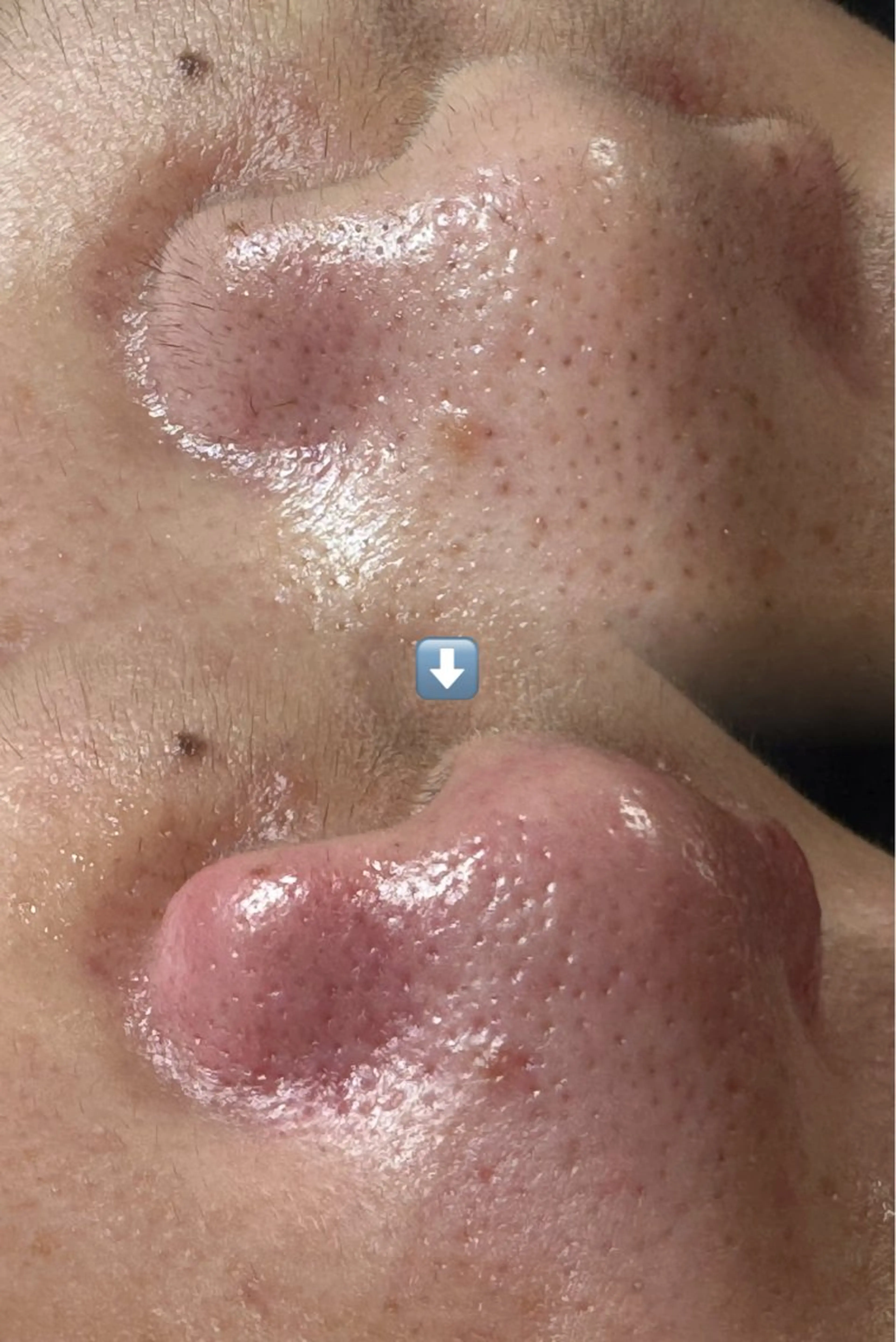 エステ M&Y Nanami🤍ྀིの眉毛・アイブロウイメージ