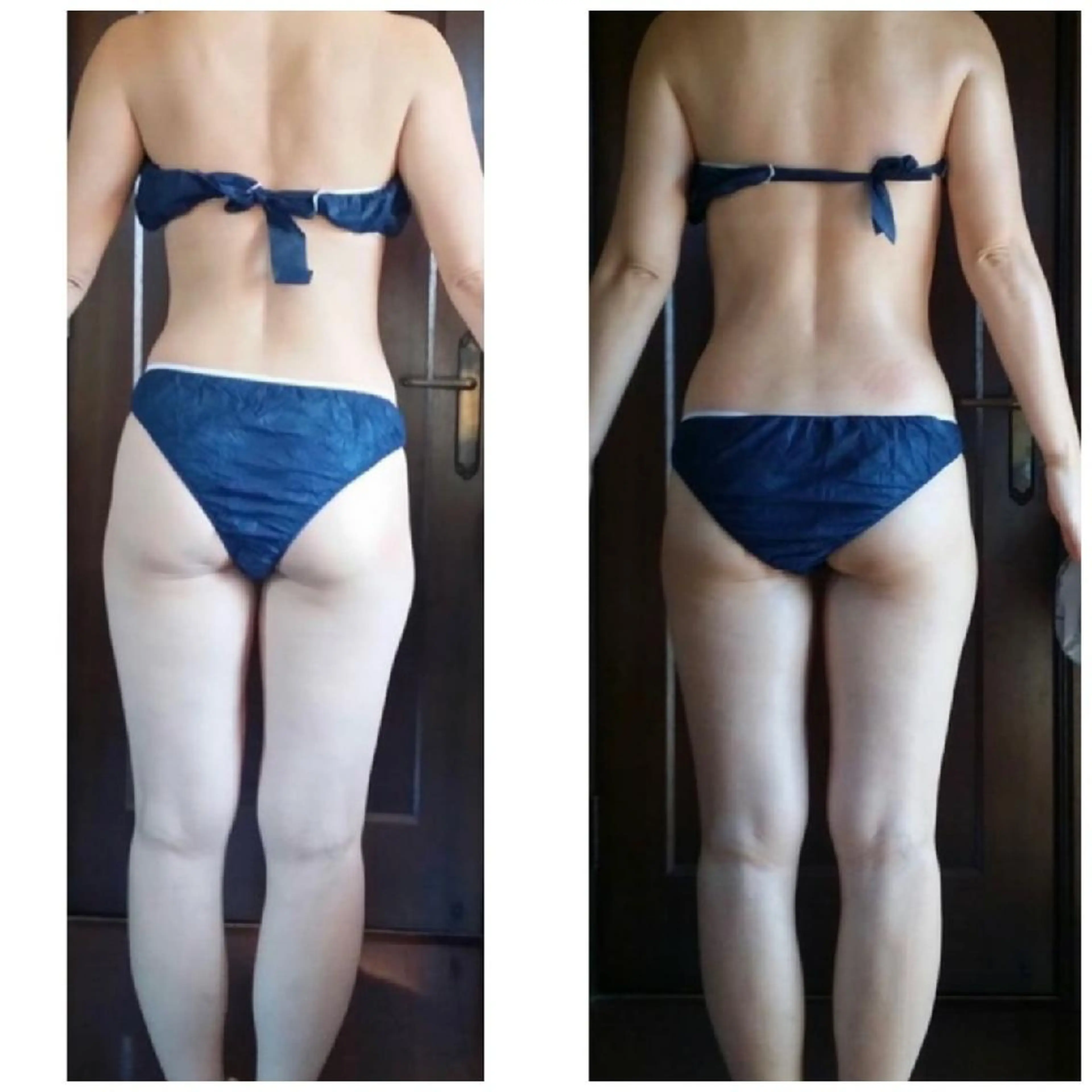 【痩せたい大人女子必見♥️】ほぐして溶かして流し込む全身速攻痩せコース の写真