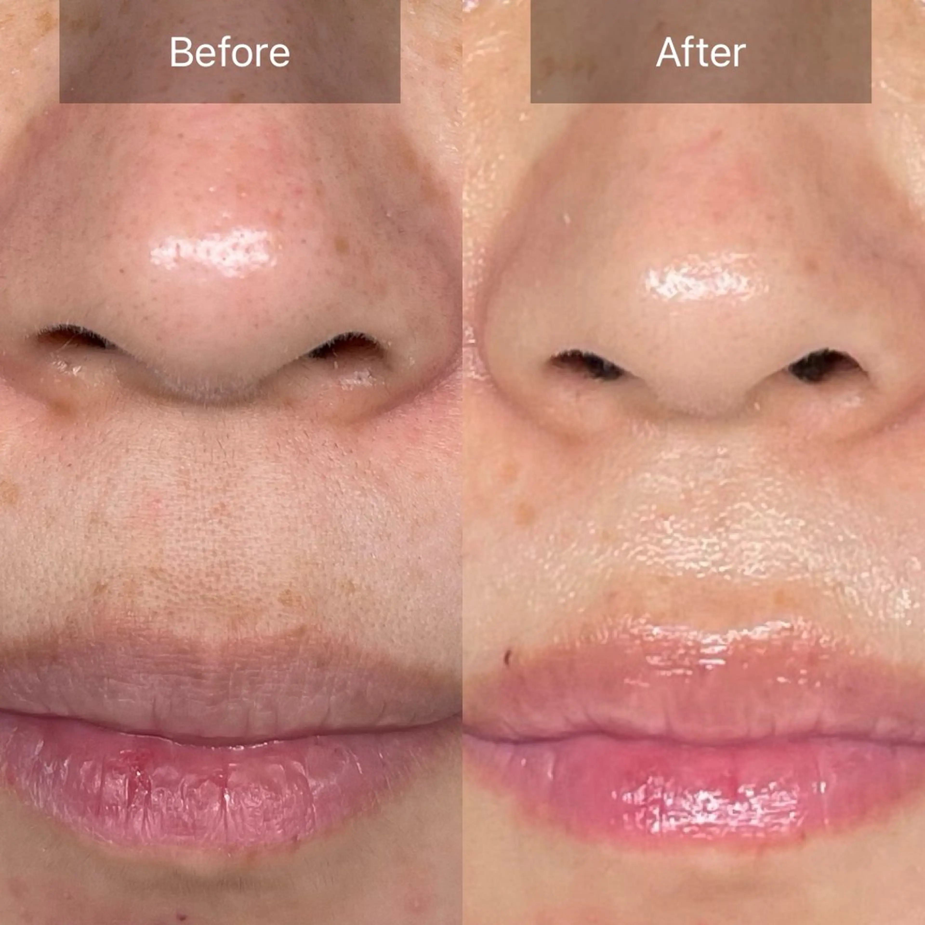 エステ loa まつ毛と肌管理のお店のマツエク・マツパデザイン