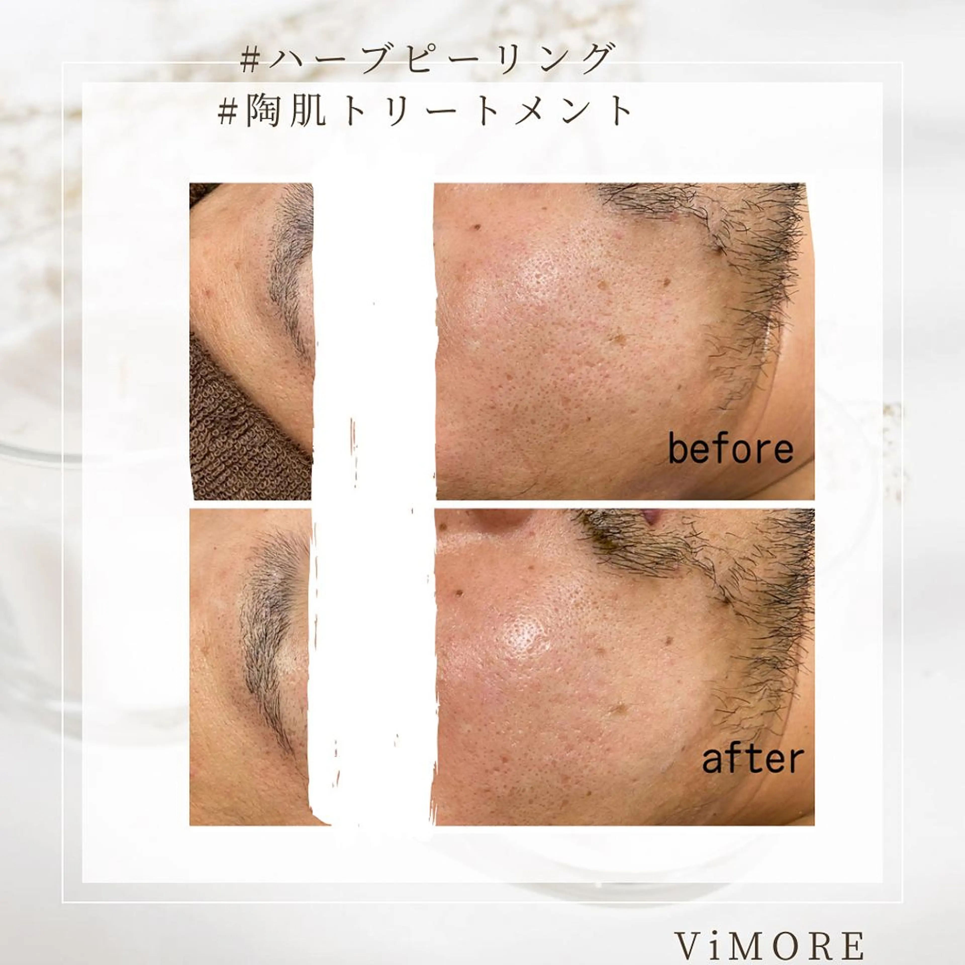 エステ ViMORE あやのネイルデザイン