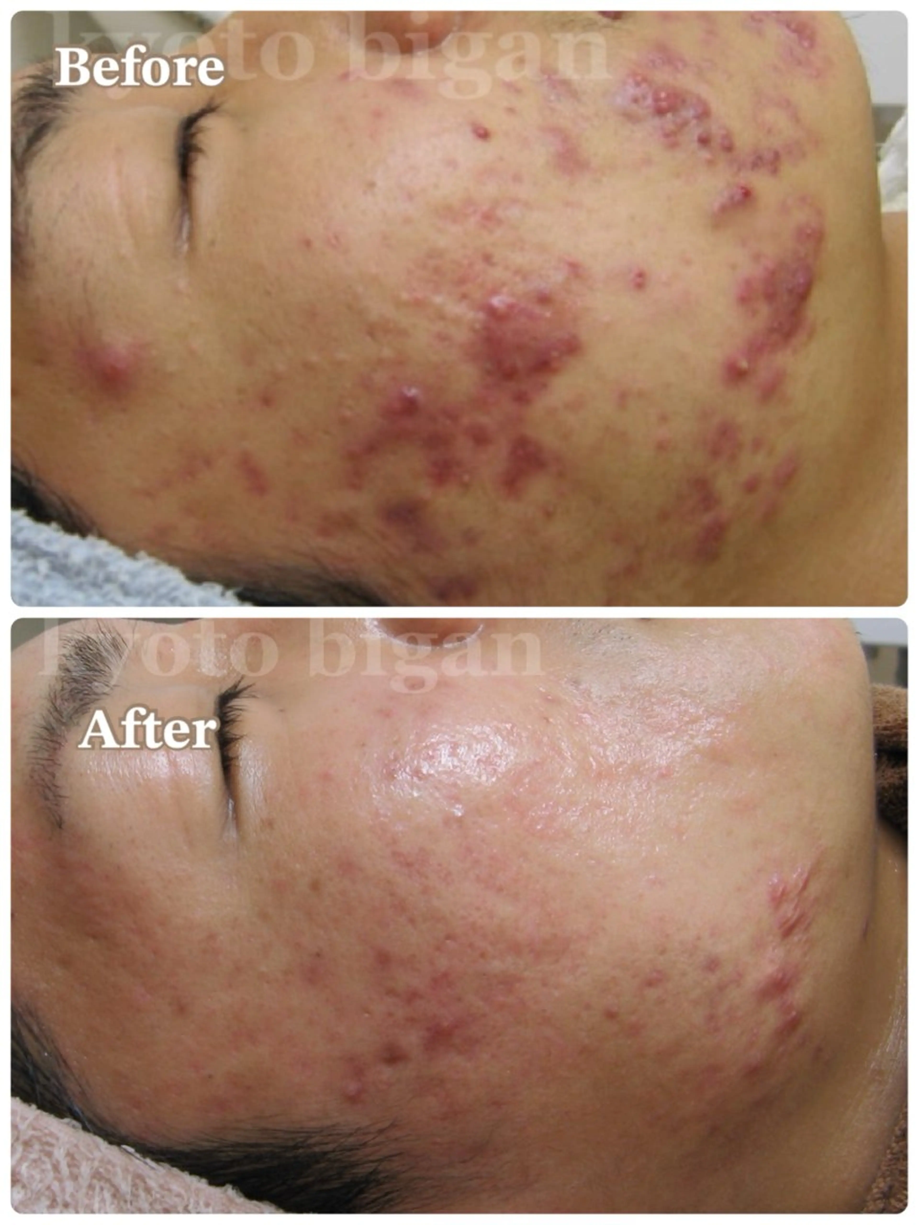 メンズ エステ さかた さと美のエステ・リラクイメージ