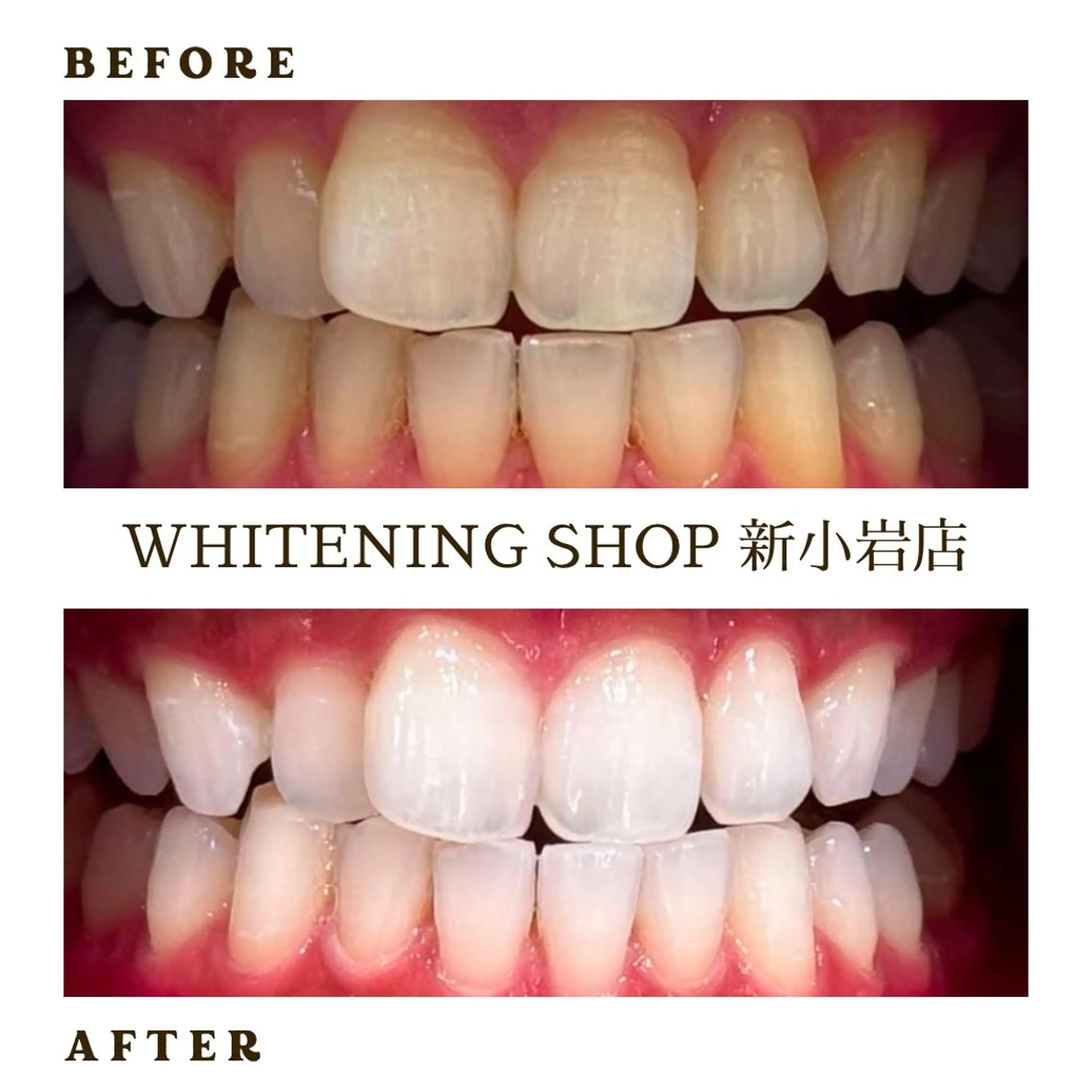 メンズ その他 ホワイトニング ショップ新小岩店のその他イメージ