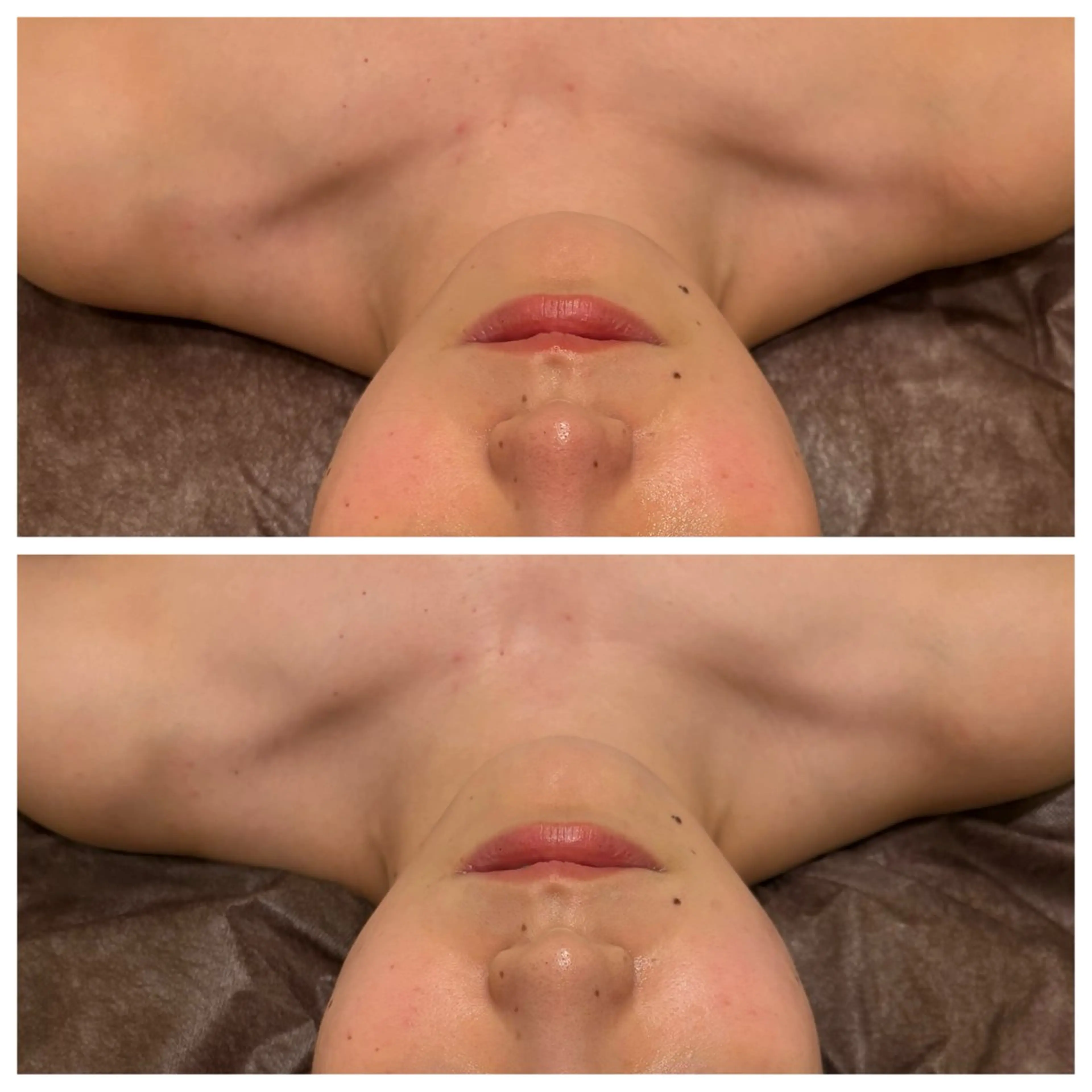 ☆痩身/小顔☆ 結果出します☆のエステ・リラクイメージ