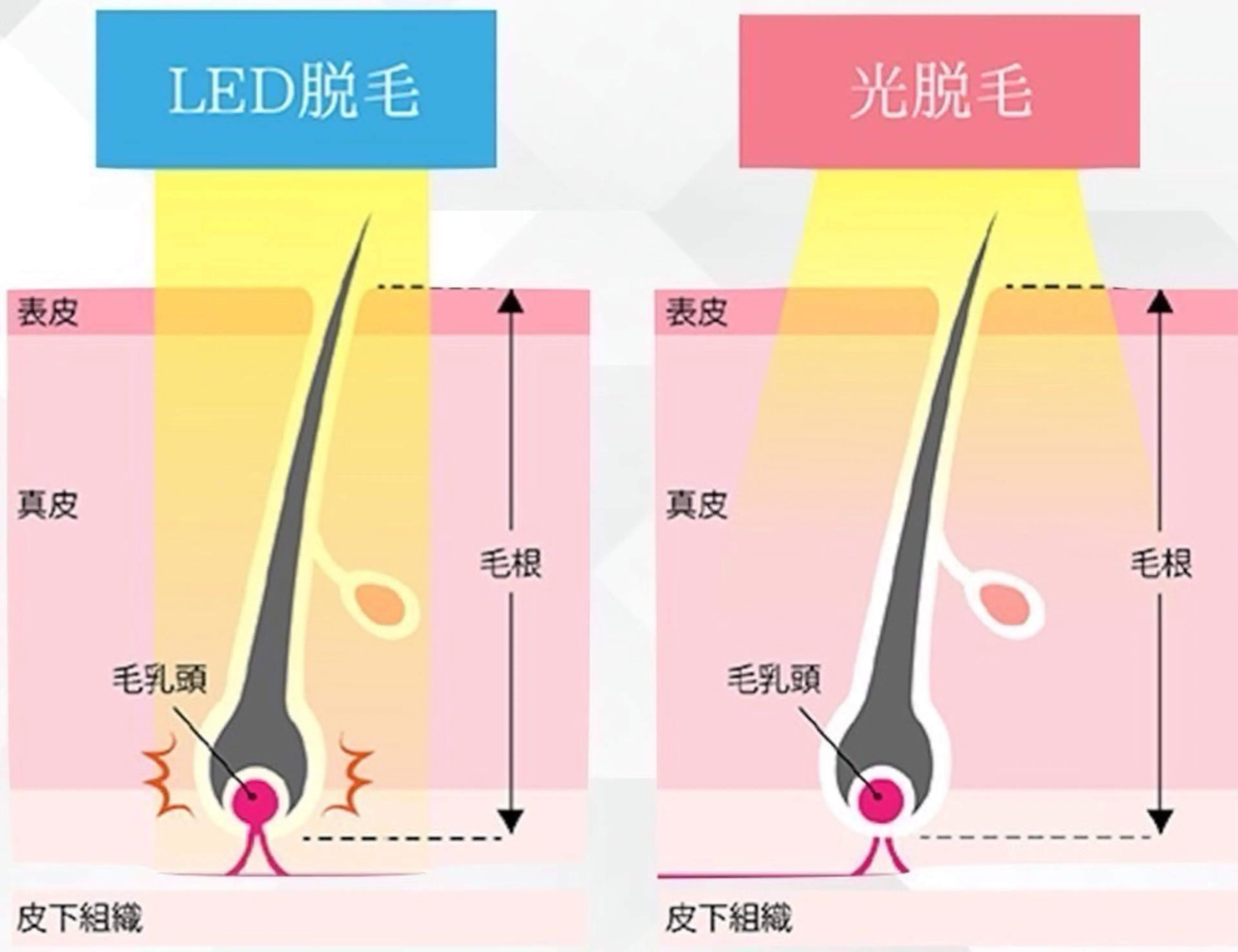メンズ Grazie 及川のエステ・リラクイメージ