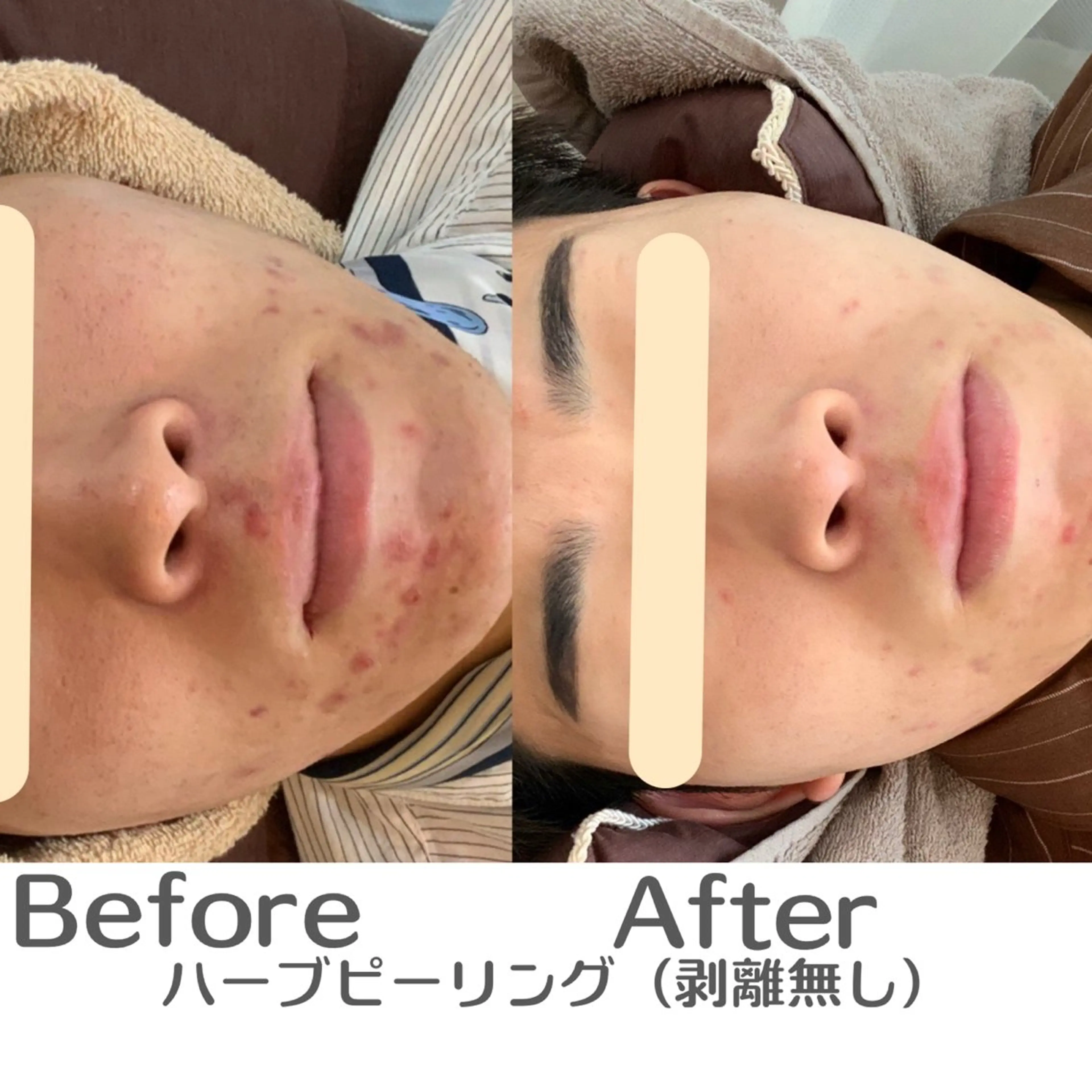 エステ 最速小顔・肌管理 espoirのエステ・リラクイメージ