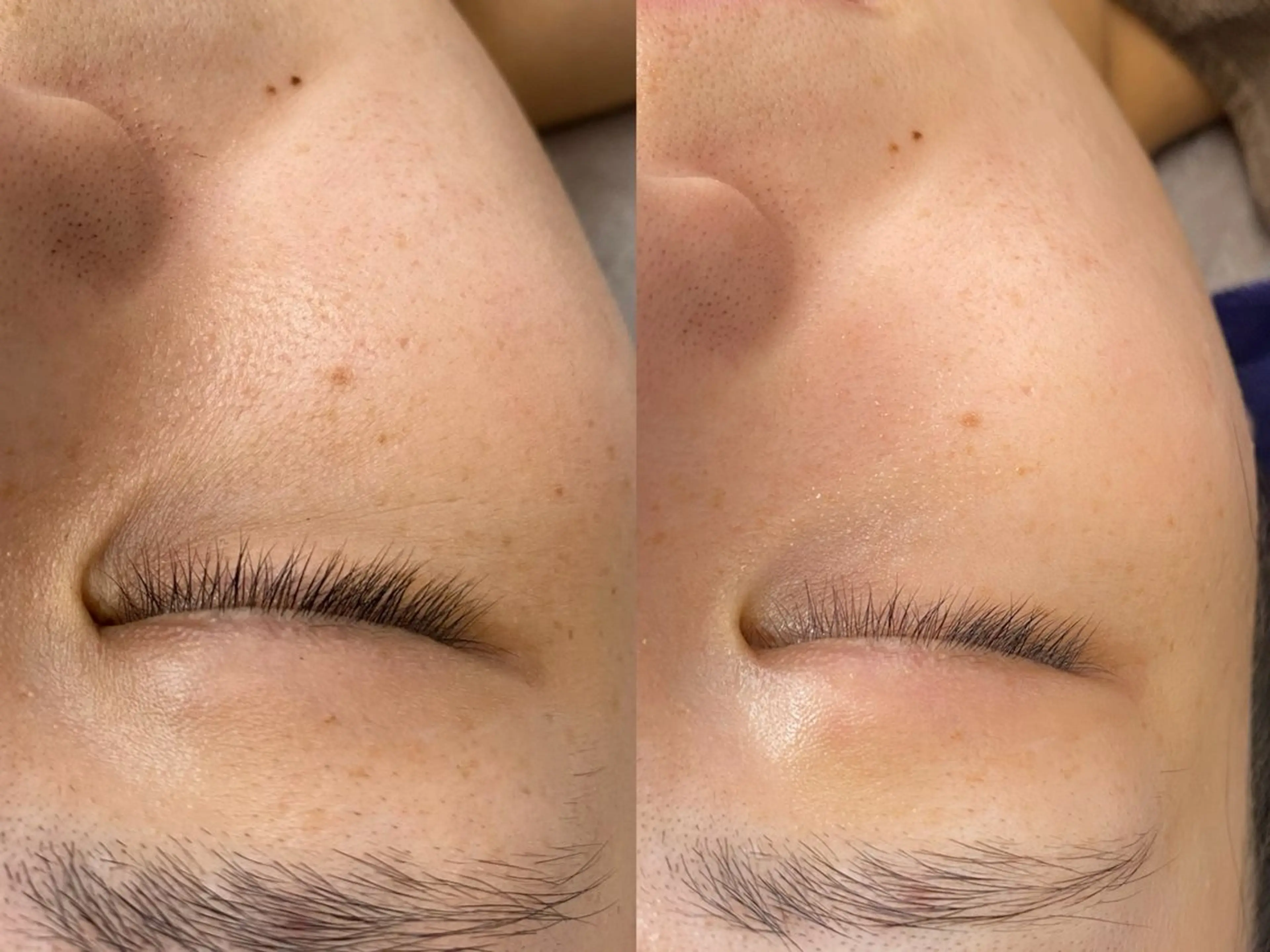 エステ BELXIA所属・井櫻 玲香のエステ・リラクイメージ