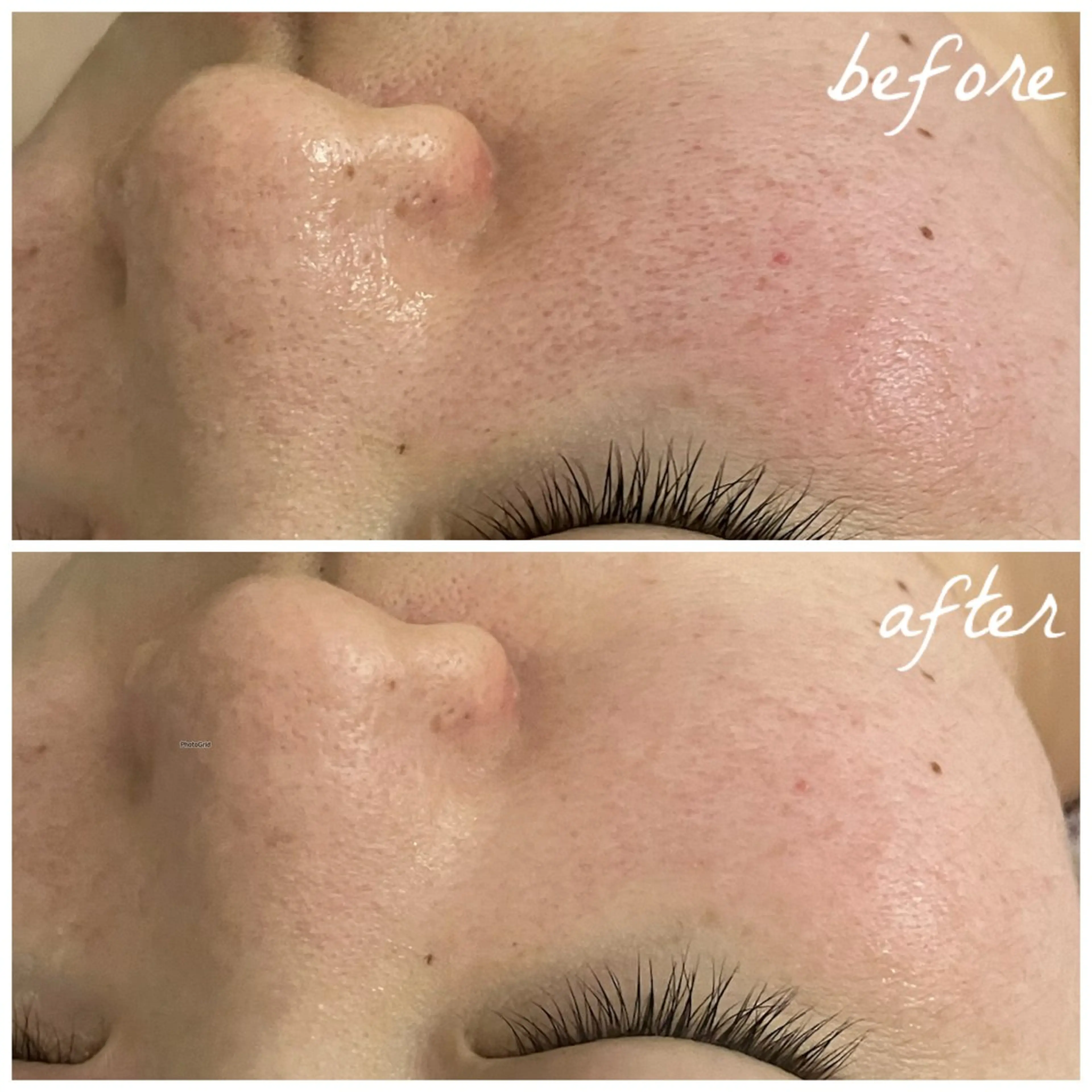 メンズ エステ メナード岐阜茜部 杉浦のエステ・リラクイメージ