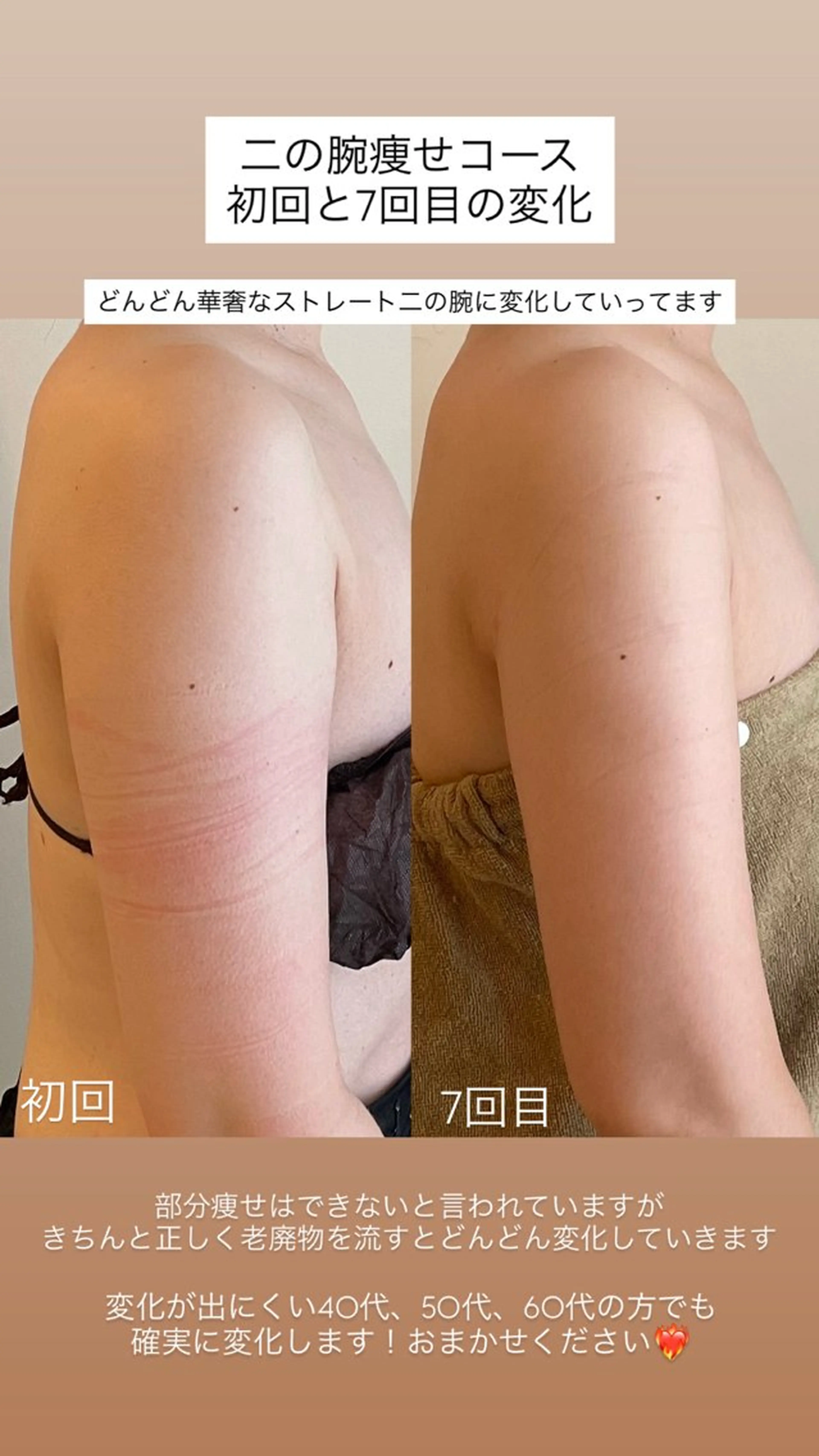 エステ New所属・New __のその他イメージ