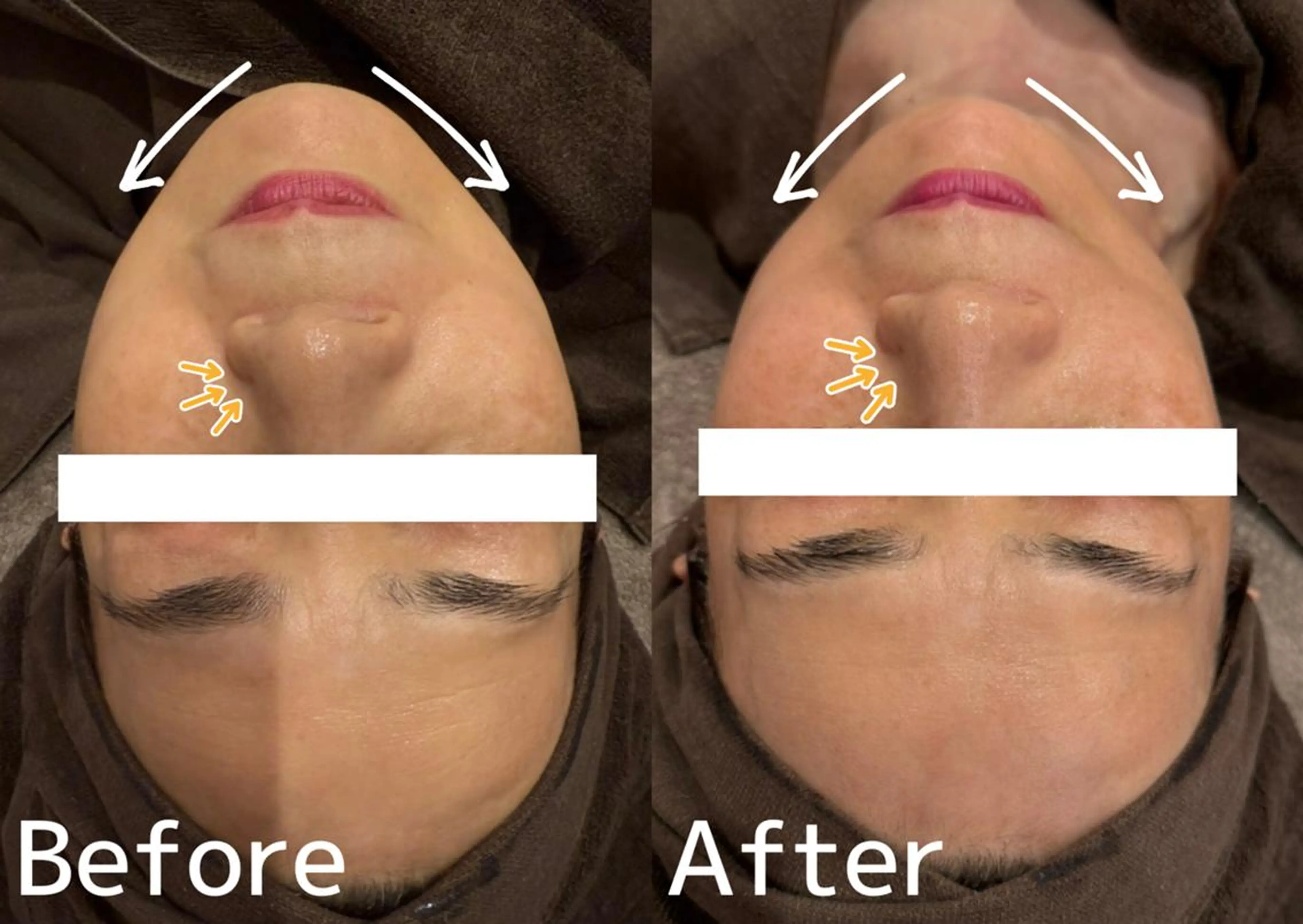 脱毛＆小顔；ミアンカ 京橋京阪モール店のエステ・リラクイメージ