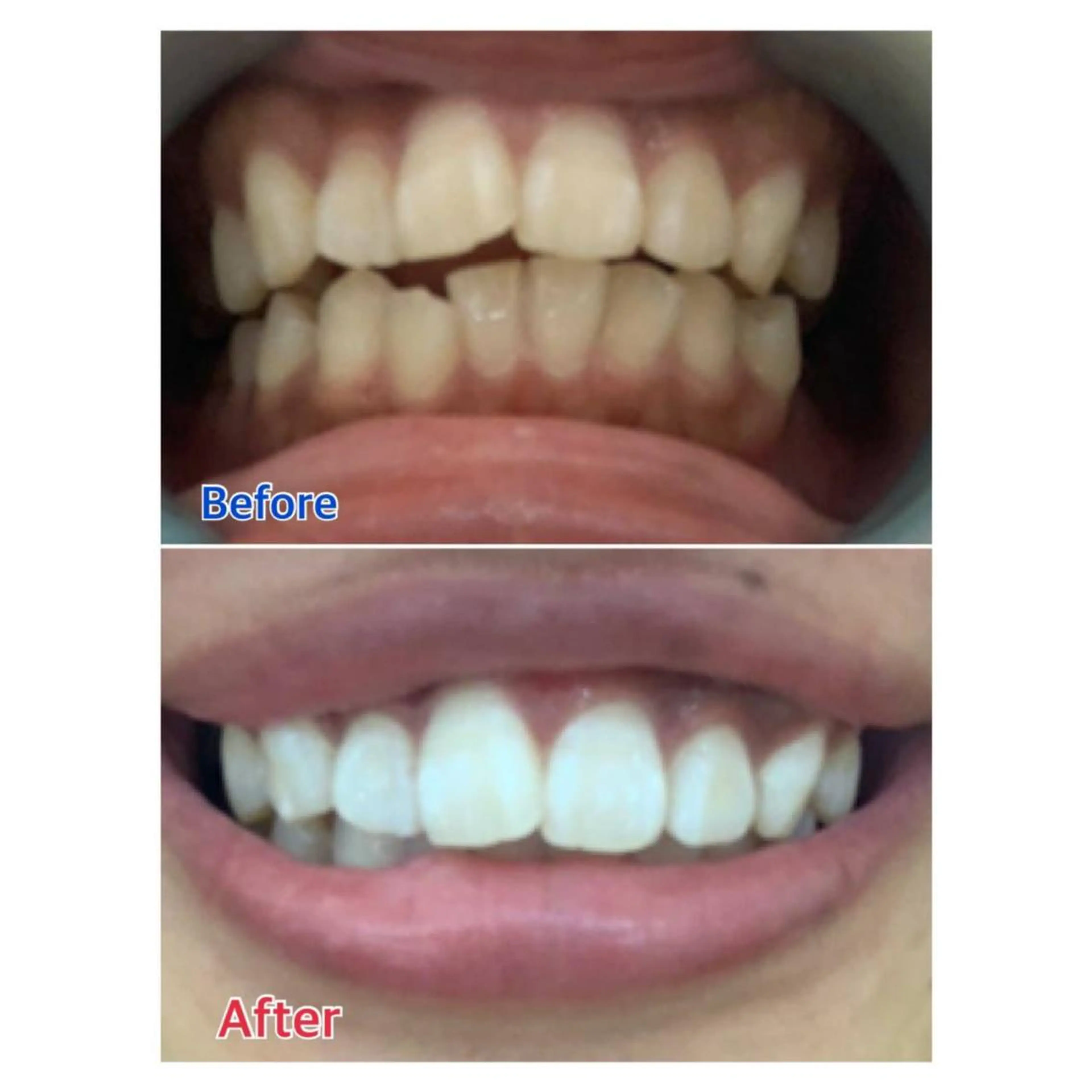 MBEAUTYSALON 千葉店・京成大久保所属・Melty 輝のその他イメージ