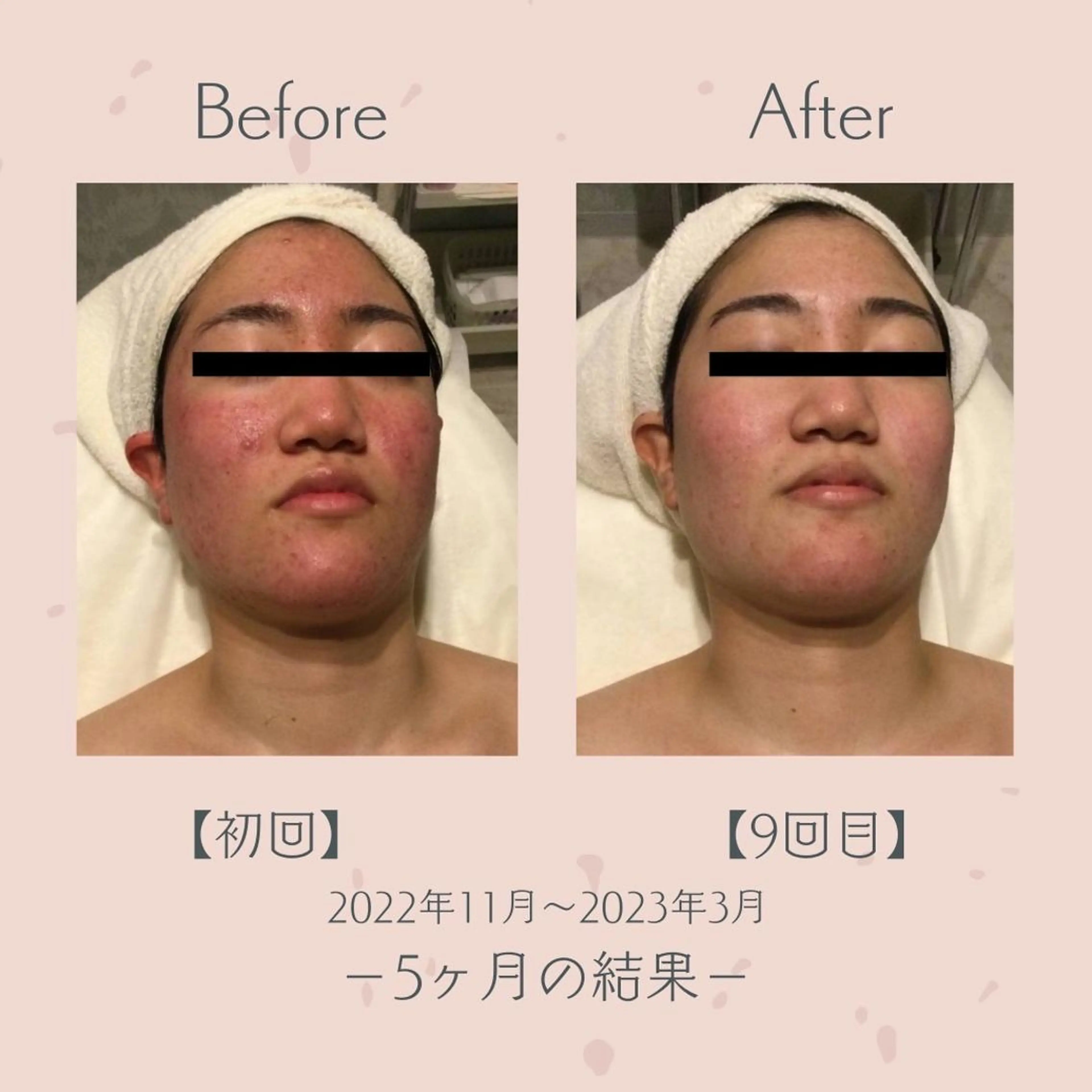 エステツイン広島店 FacialBodyのエステ・リラクイメージ