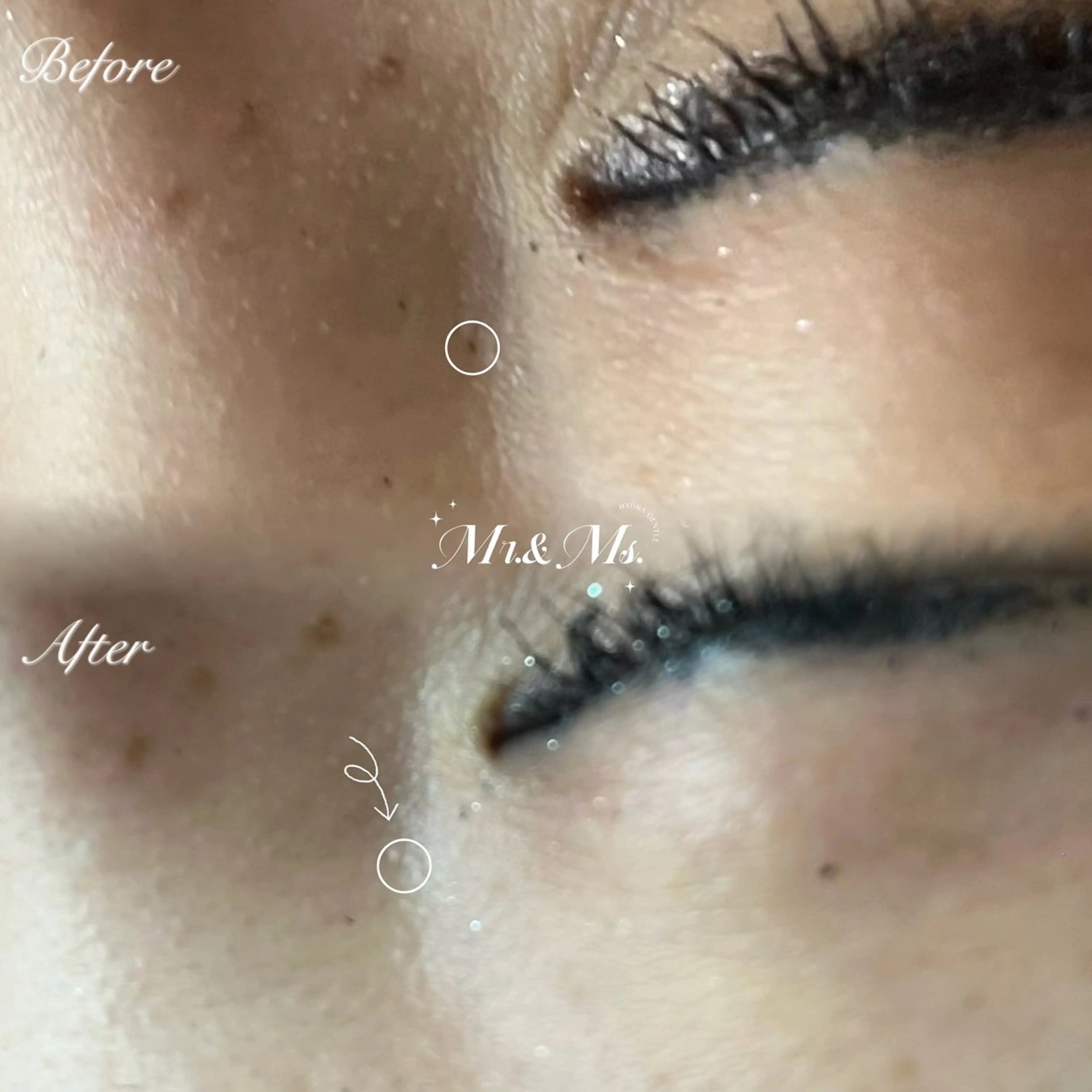 その他 Mr.&Ms.脱毛 YUNAの眉毛・アイブロウイメージ
