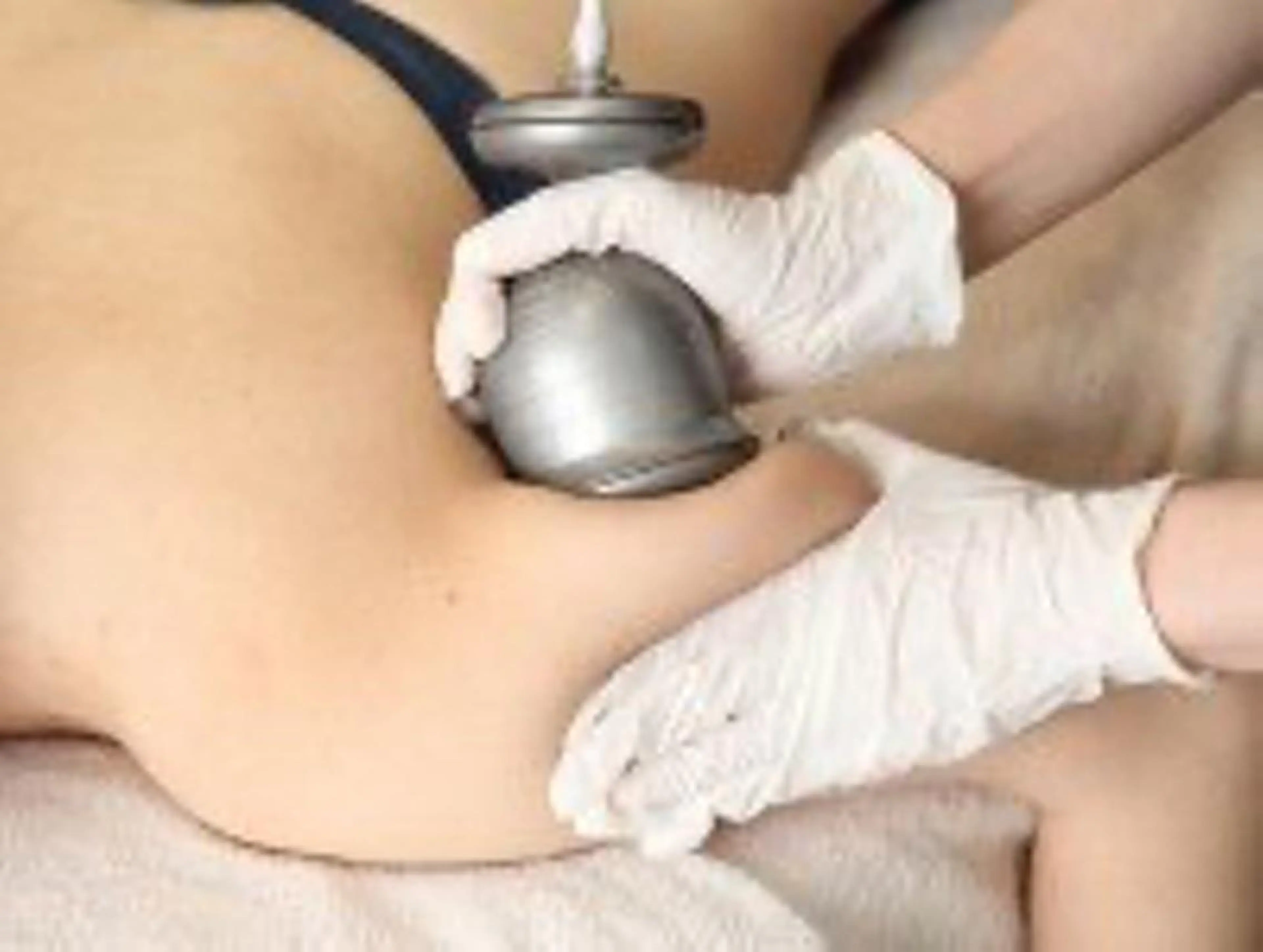 【Wマシン二の腕コース¥5000】本気で痩せたい！人気マシンが両方できるの写真