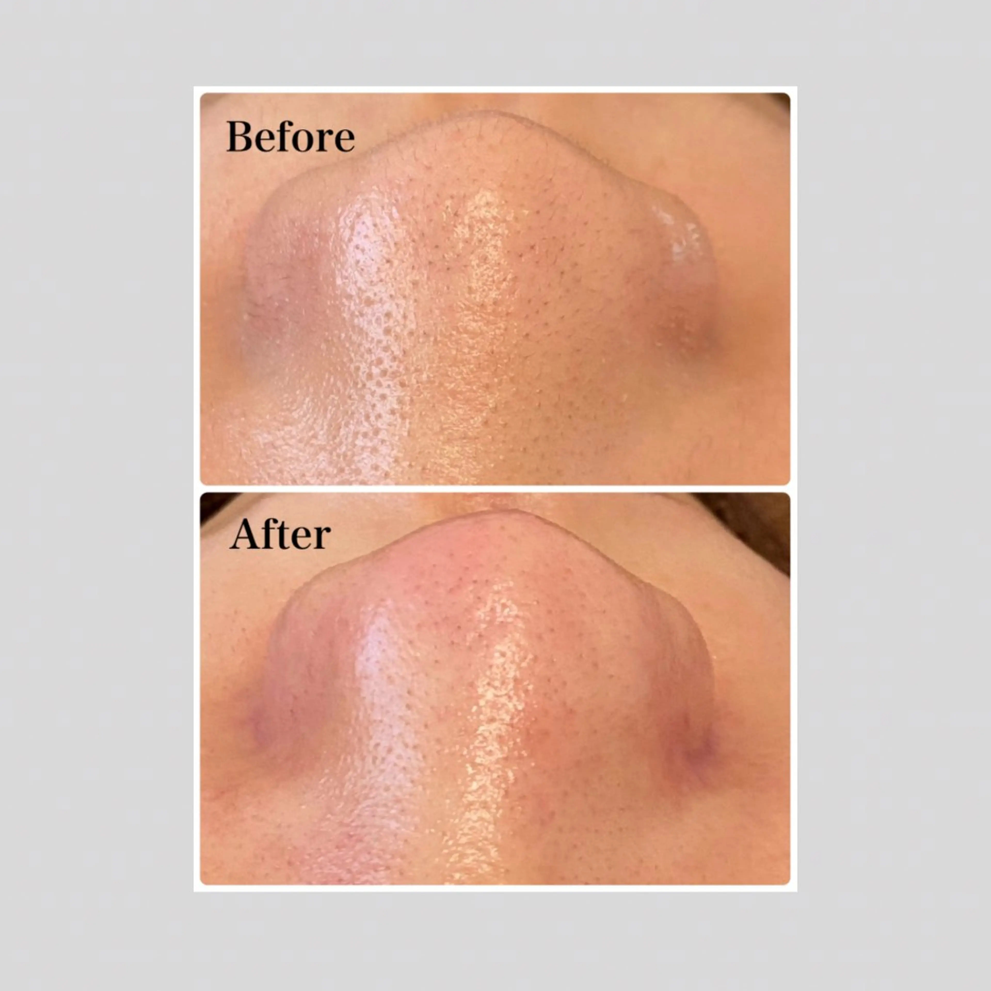 マツエク・マツパ 韓国風マツエク エステ リラク 韓国肌管理 【毛穴専科】のエステ・リラクイメージ