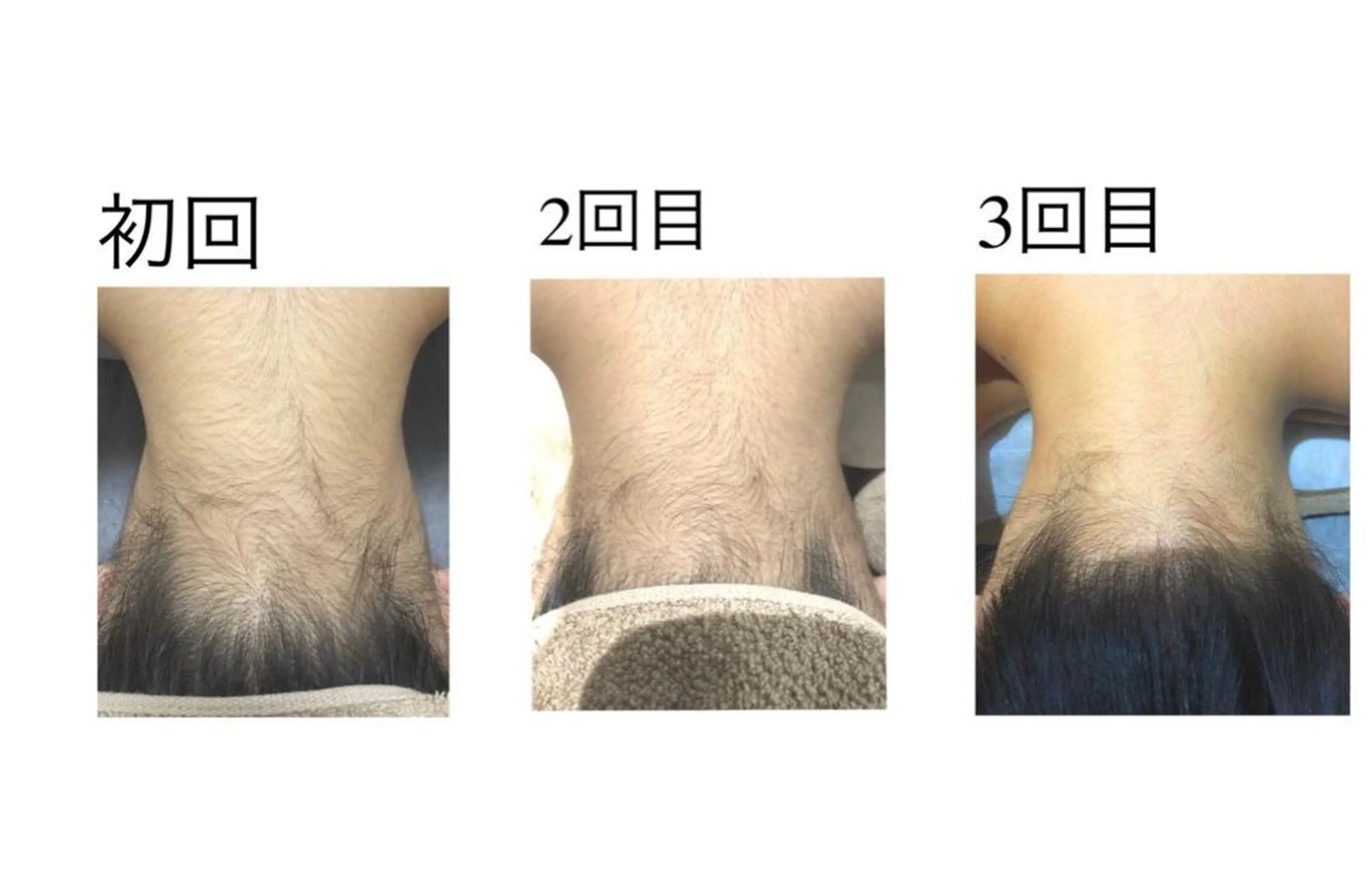 脱毛 昼間 貴子のエステ・リラクイメージ